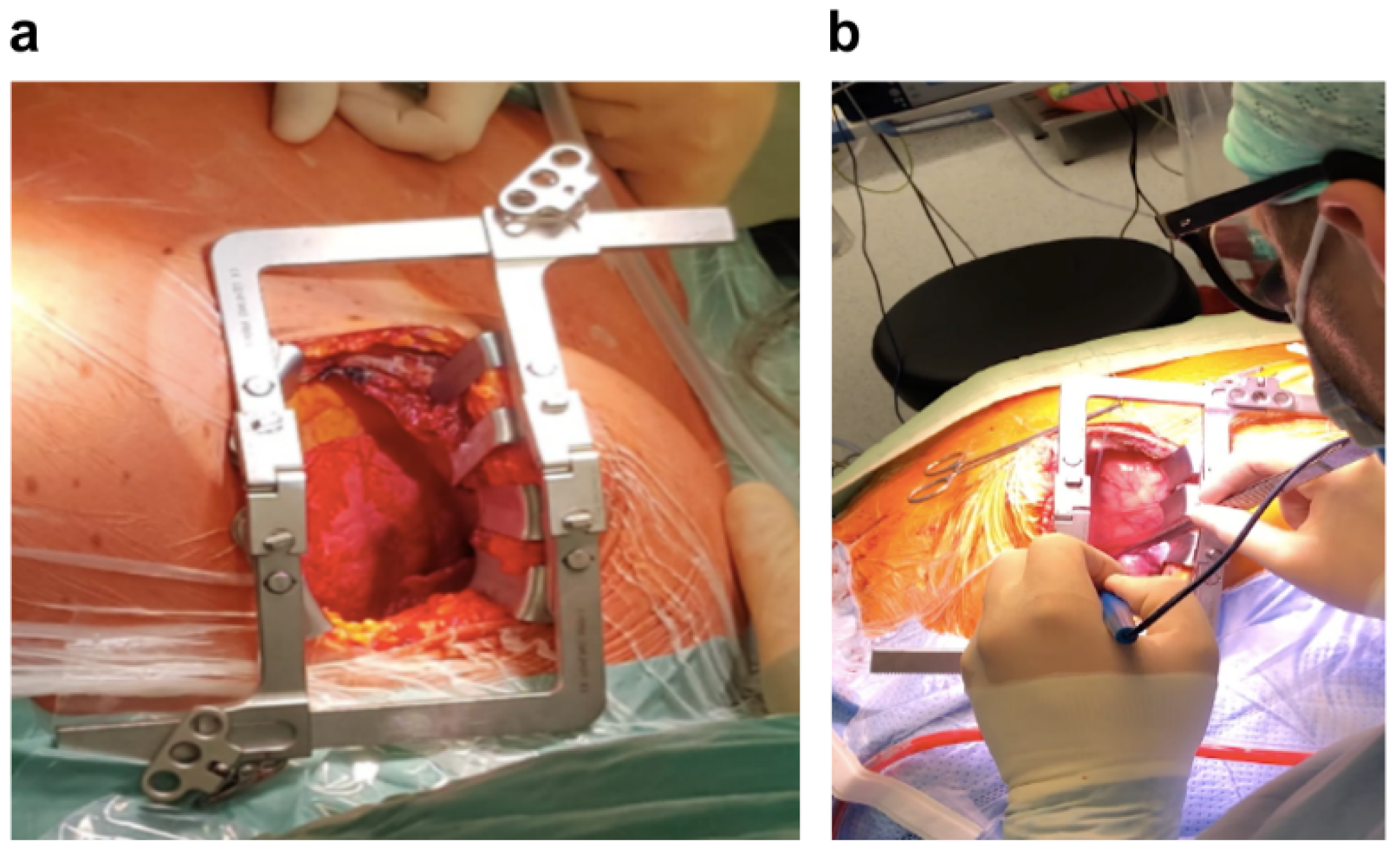 Jcdd 09 00457 g004 Jcdd 09 00457 g004