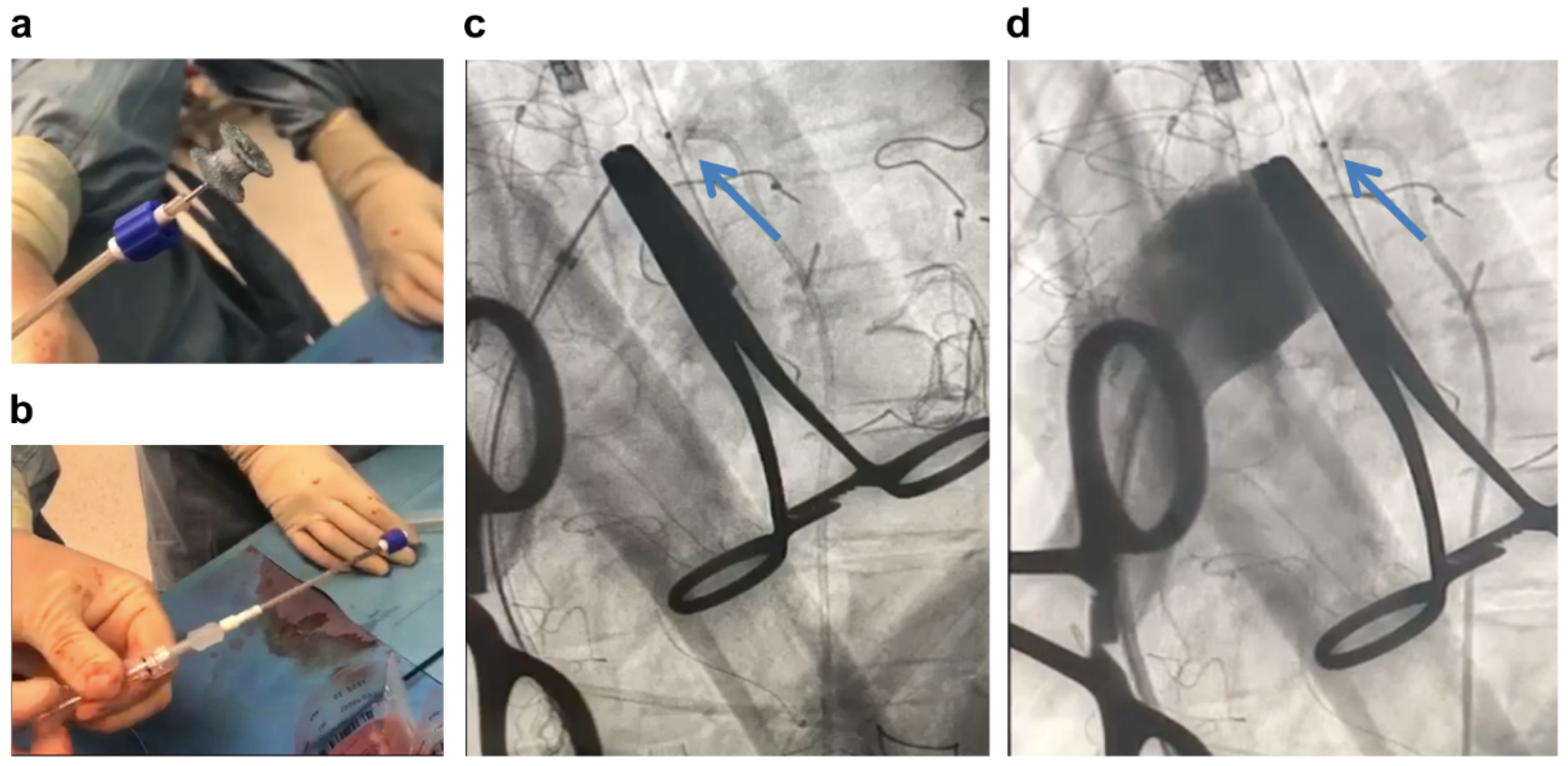 Jcdd 09 00457 g005 Jcdd 09 00457 g005