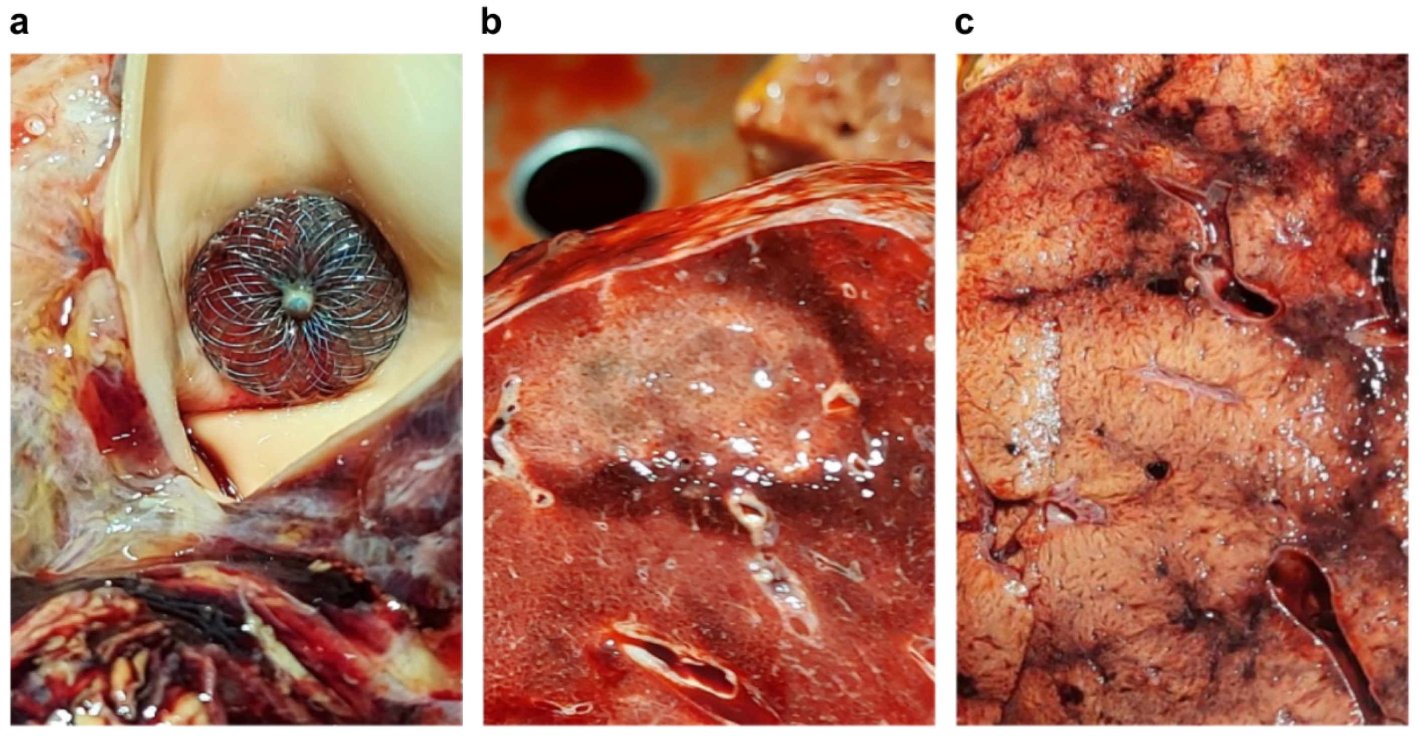 Jcdd 09 00457 g006 Jcdd 09 00457 g006