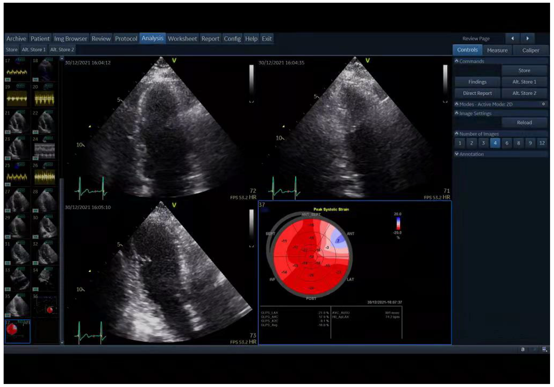 Jcdd 10 00010 g001 Jcdd 10 00010 g001