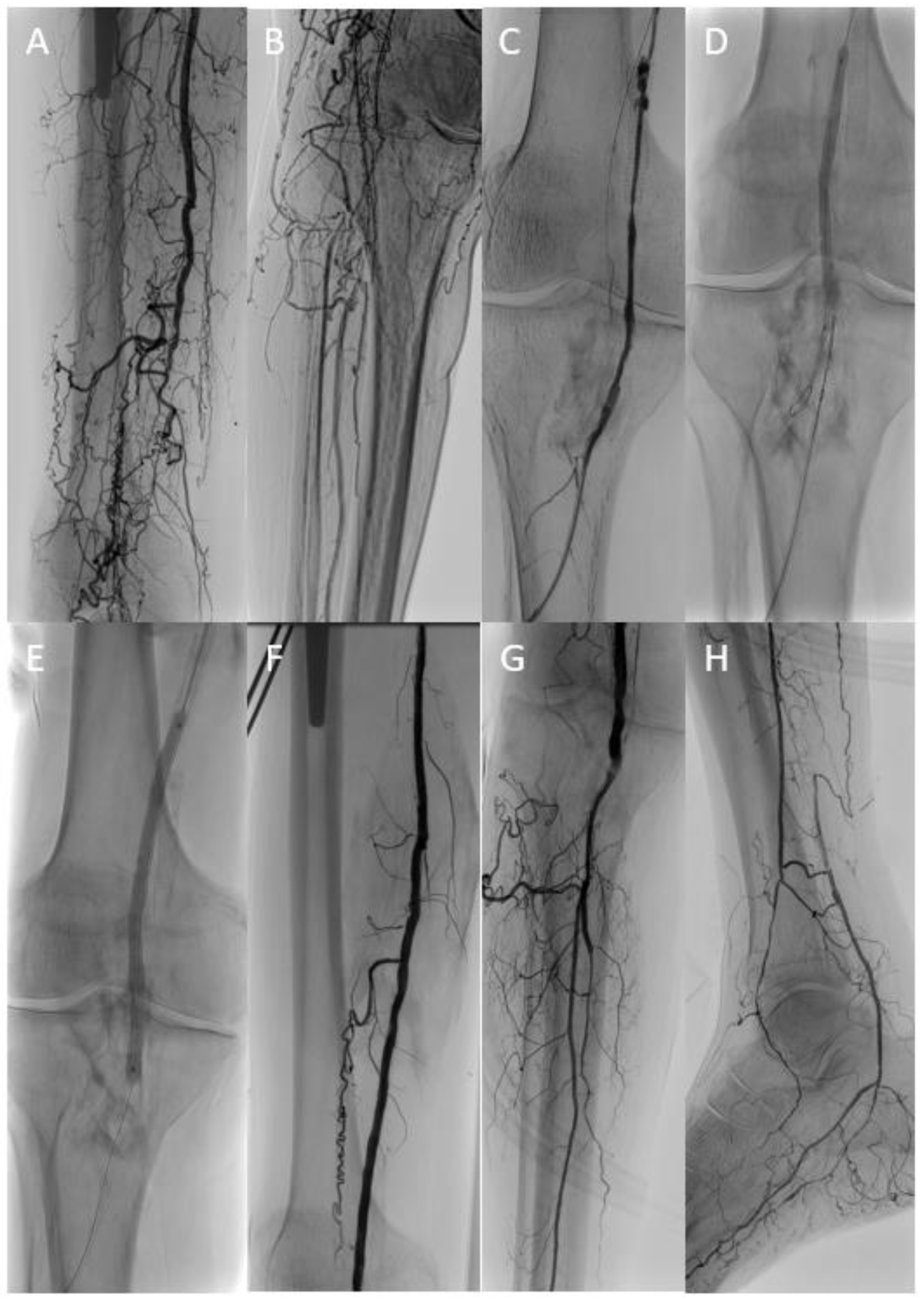 Jcdd 10 00053 g002 Jcdd 10 00053 g002