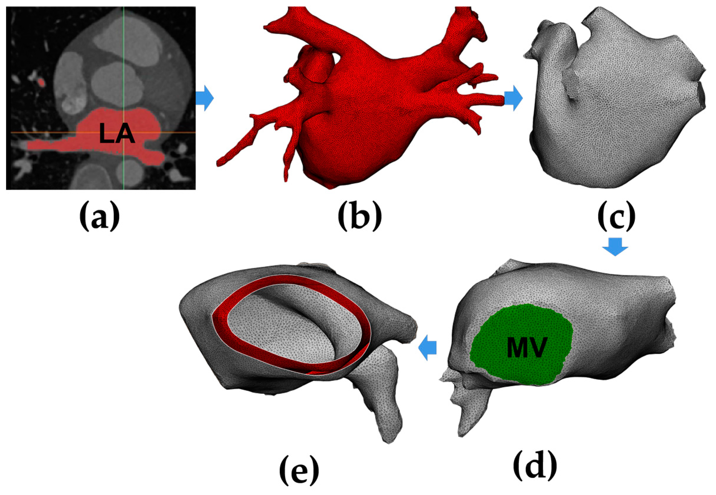 Jcdd 10 00056 g001 Jcdd 10 00056 g001