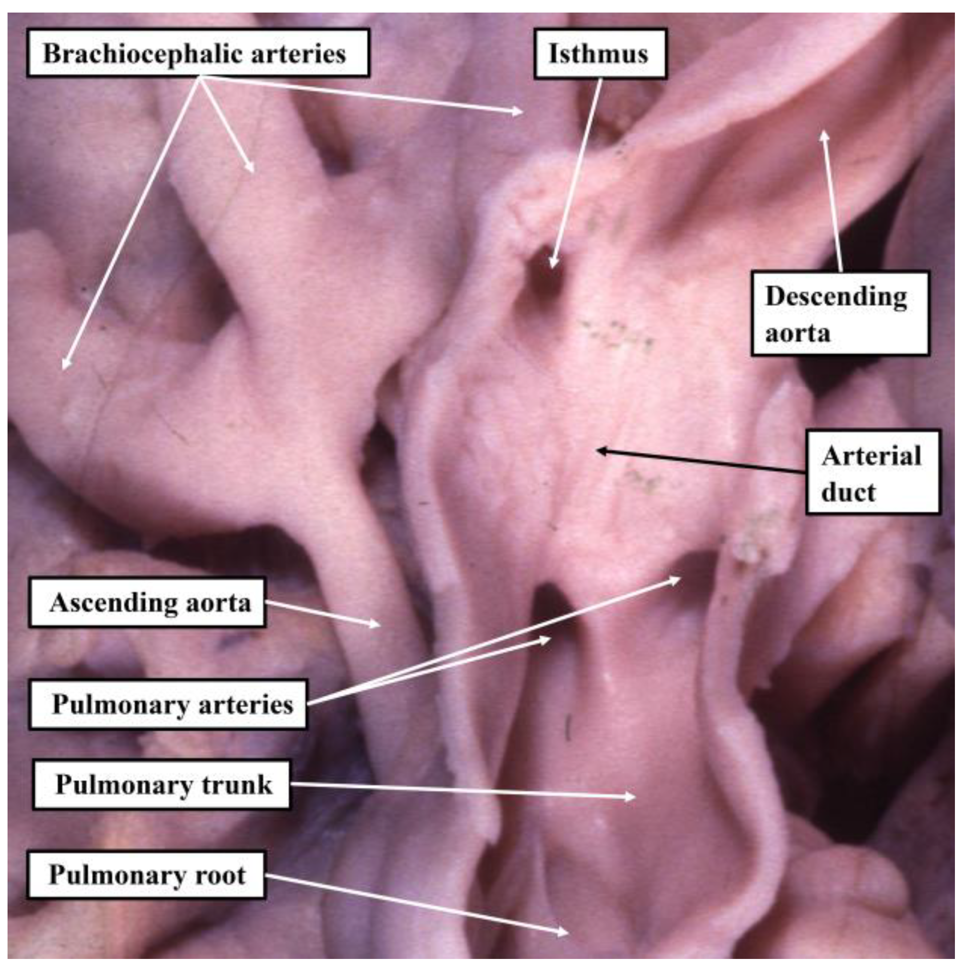 Jcdd 10 00133 g003 Jcdd 10 00133 g003