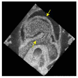 Jcdd 10 00145 i007 Jcdd 10 00145 i007