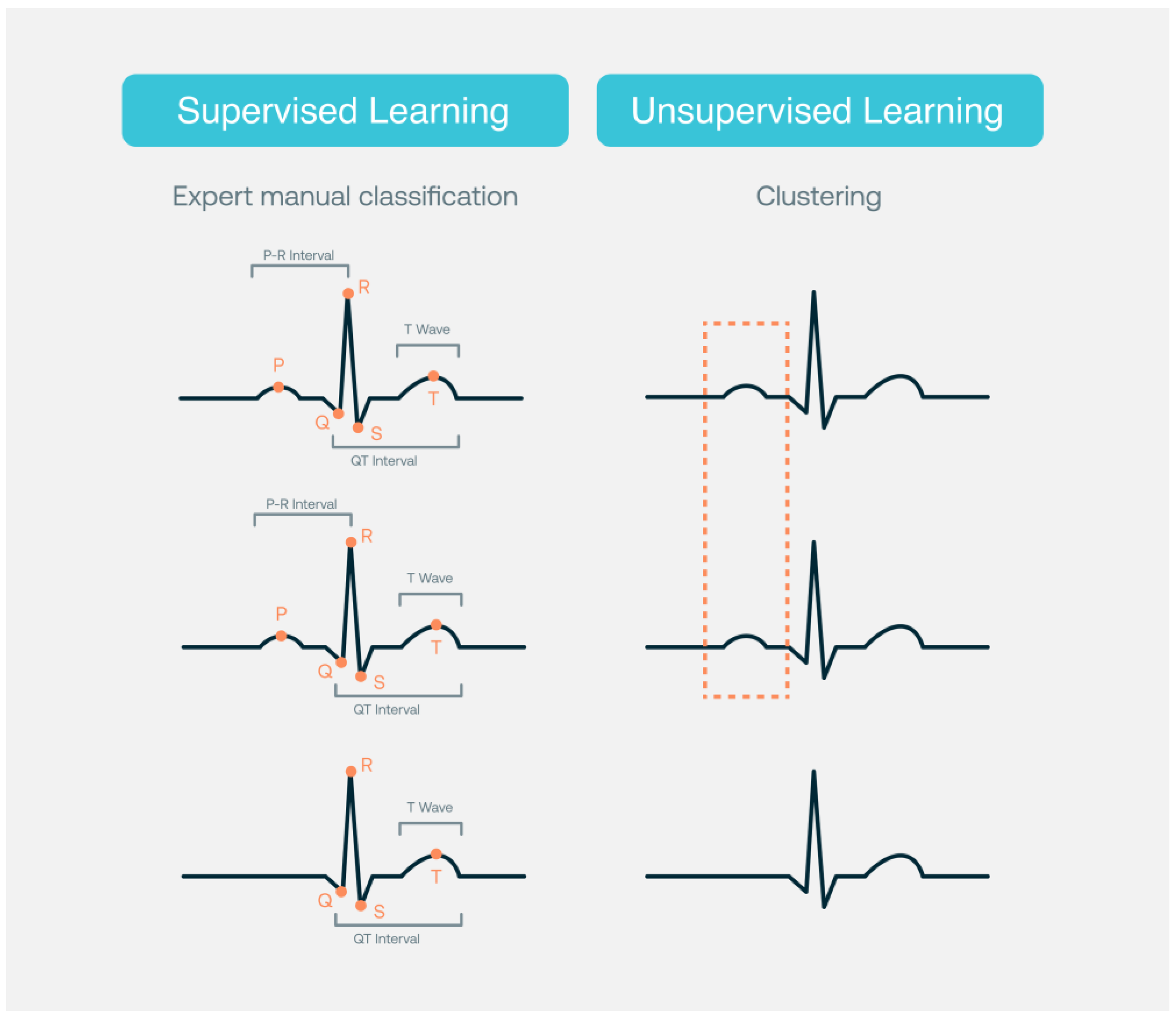 Body Scan - Activating the ECG feature – Withings