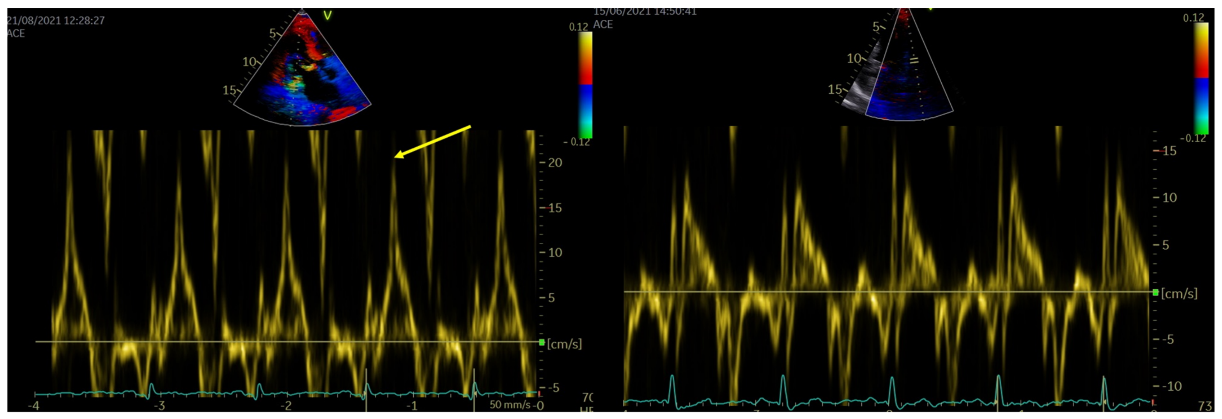Jcdd 10 00181 g002 Jcdd 10 00181 g002