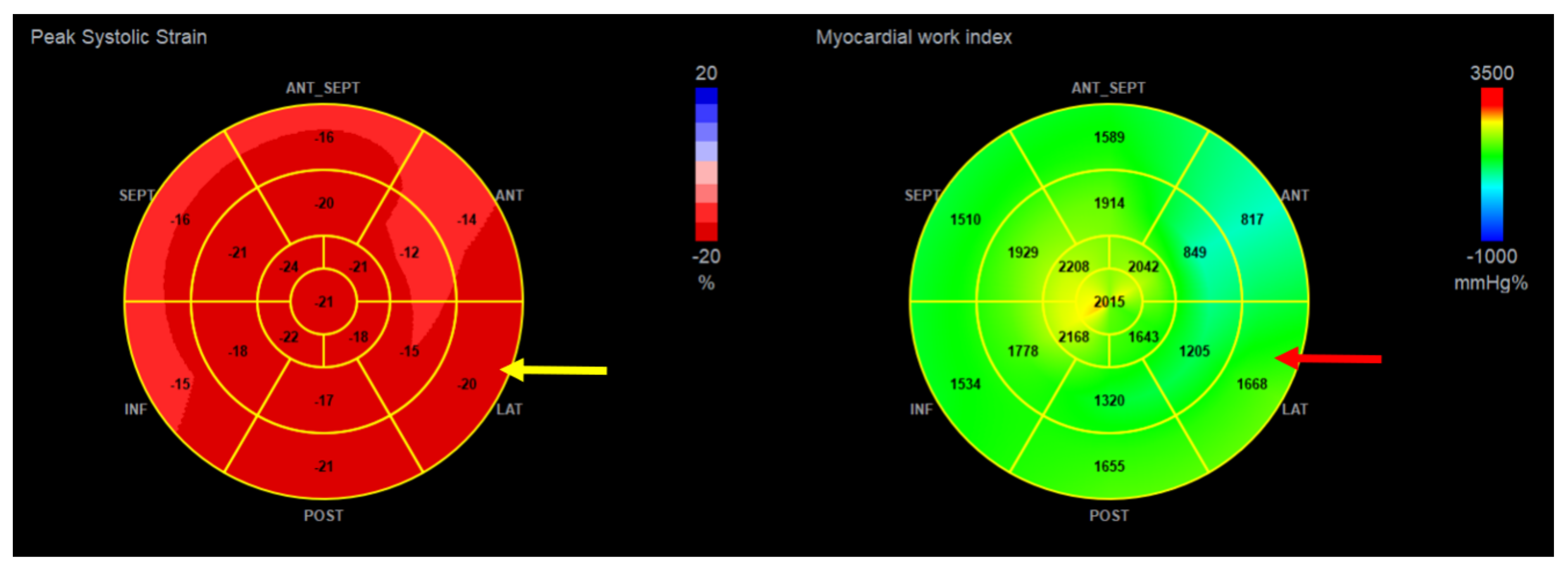 Jcdd 10 00181 g008 Jcdd 10 00181 g008
