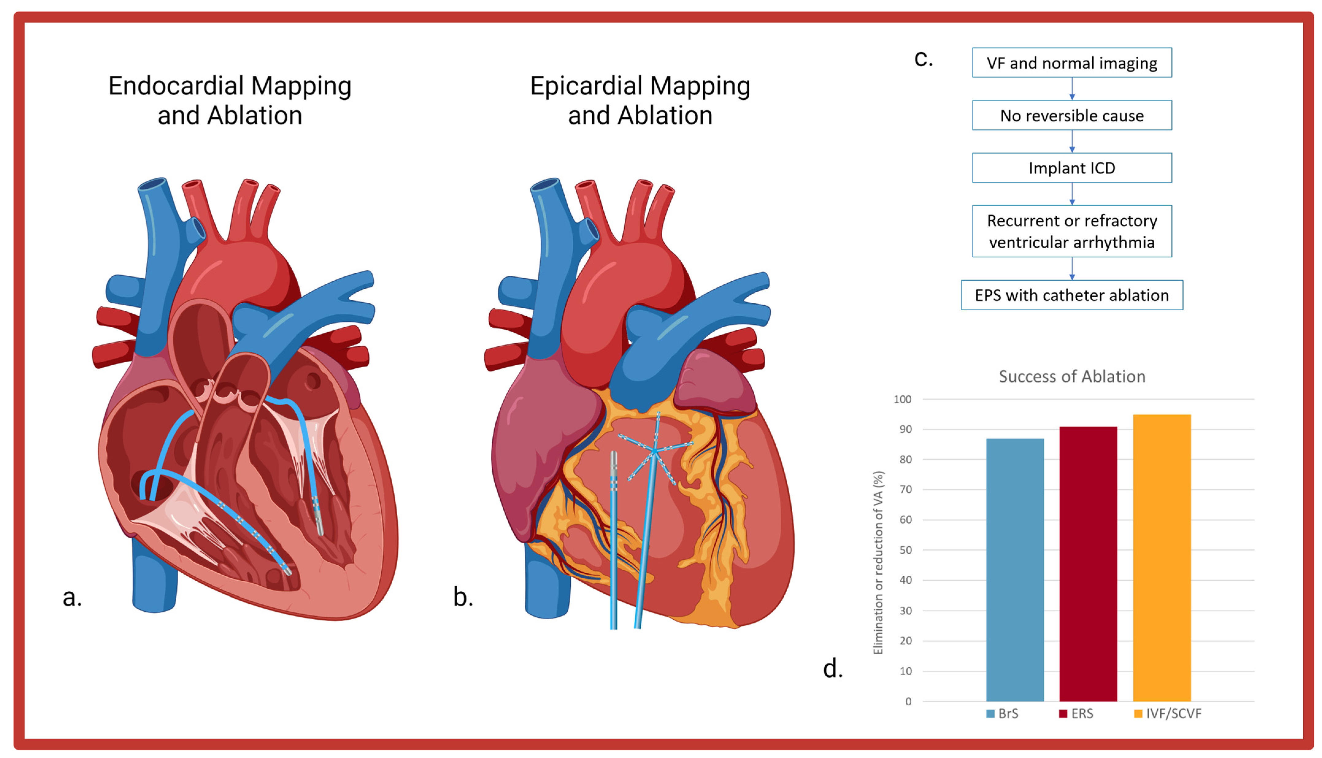 Jcdd 10 00200 g004 Jcdd 10 00200 g004