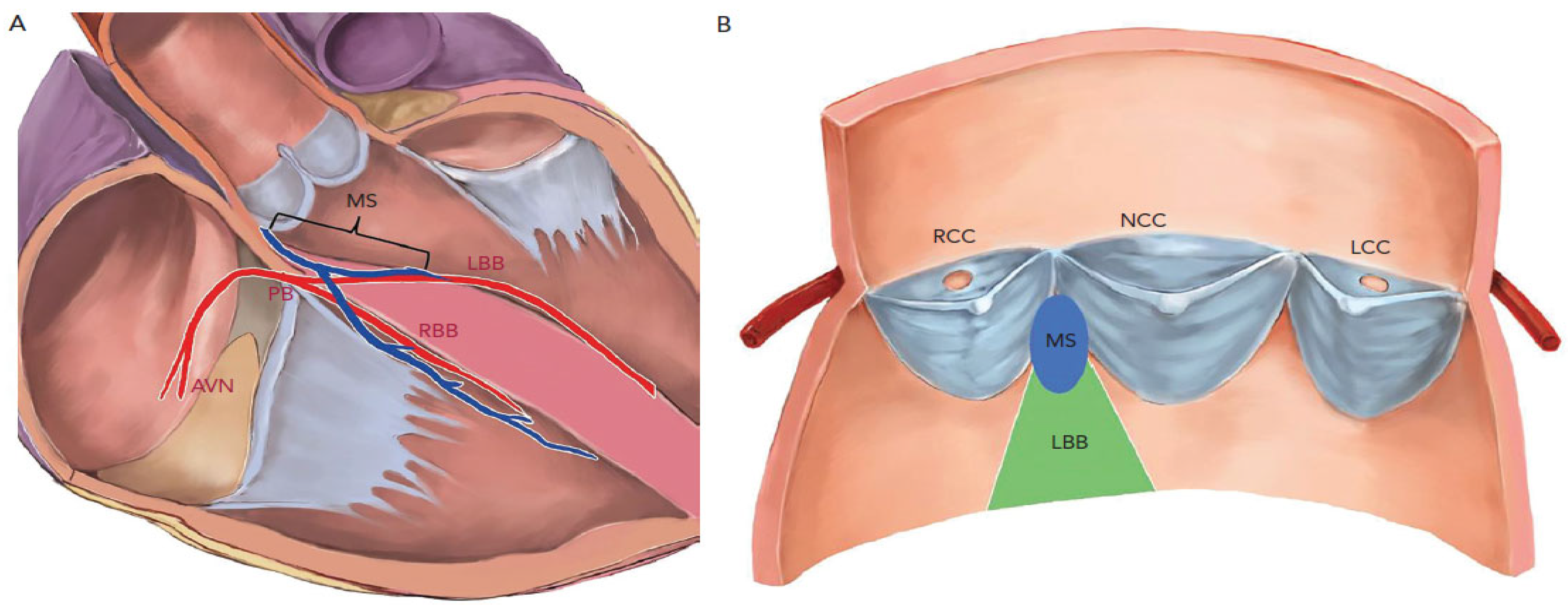 Jcdd 10 00230 g001 Jcdd 10 00230 g001