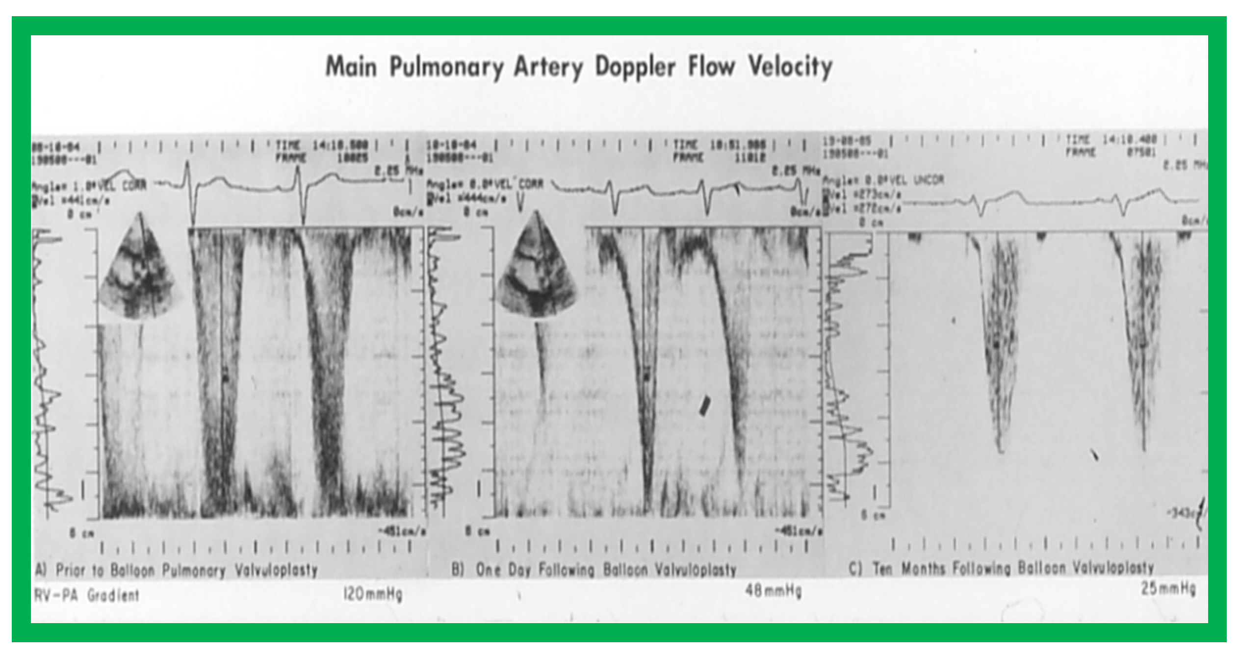 Jcdd 10 00288 g003 Jcdd 10 00288 g003