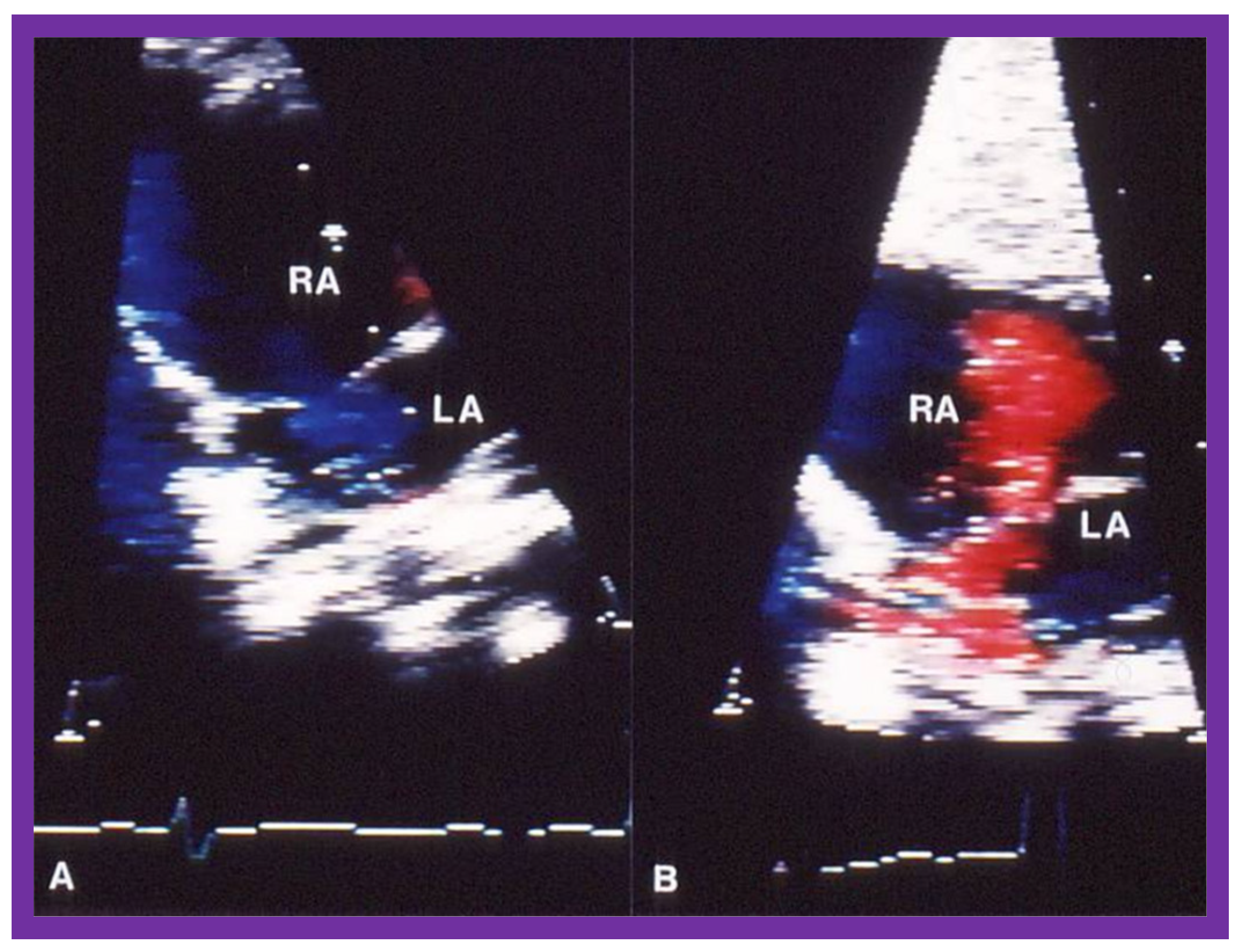 Jcdd 10 00288 g012 Jcdd 10 00288 g012