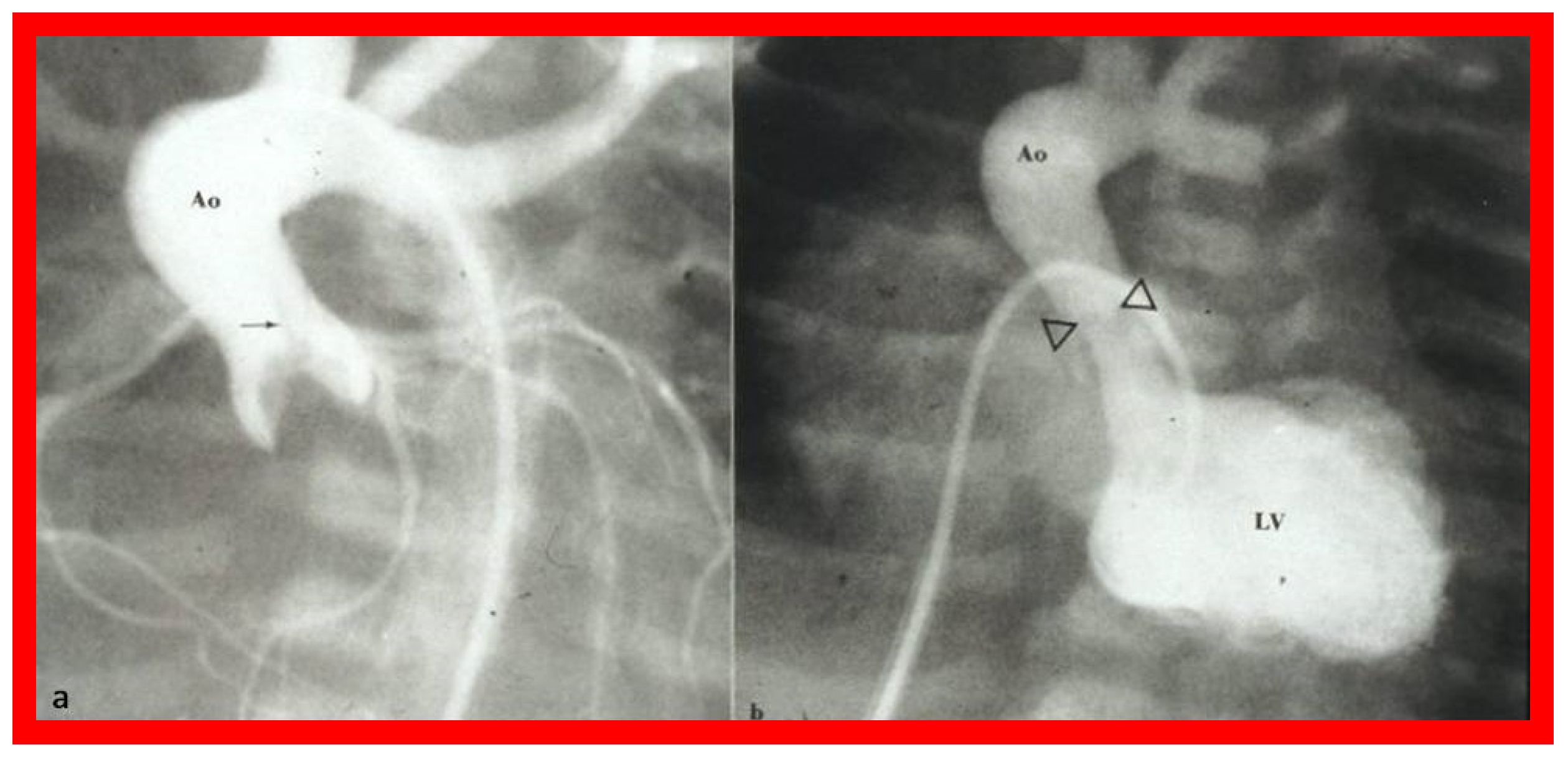 Jcdd 10 00288 g026 Jcdd 10 00288 g026