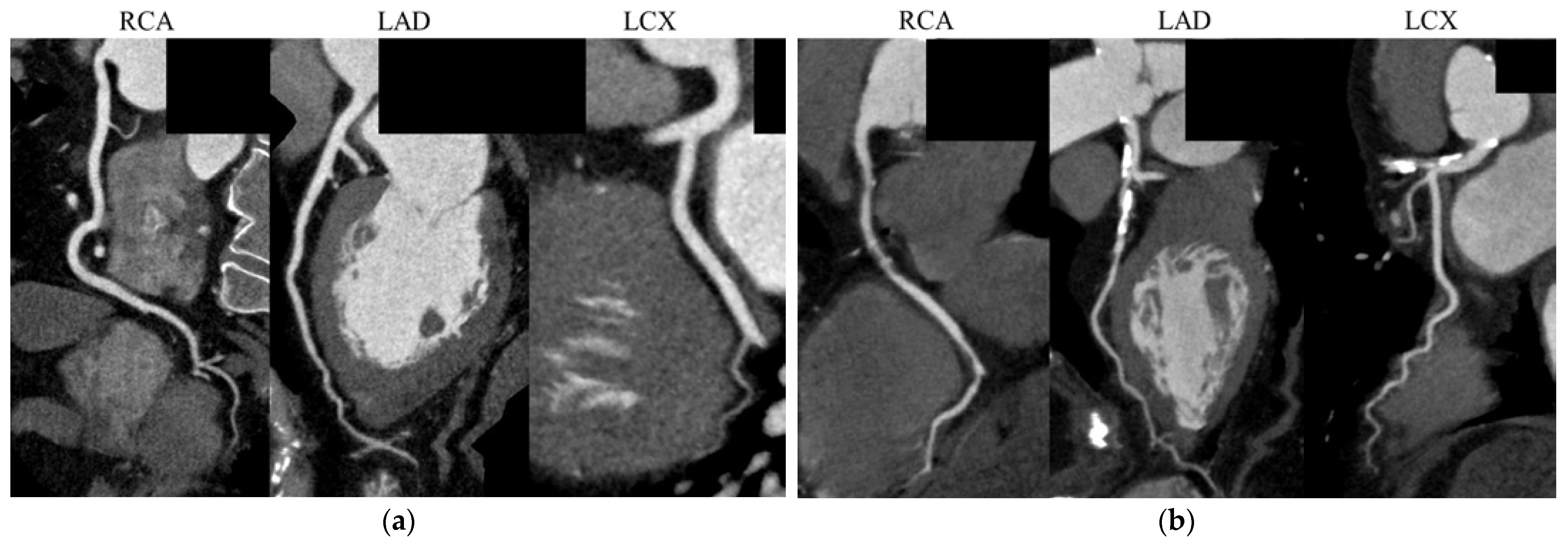 Jcdd 10 00301 g004 Jcdd 10 00301 g004