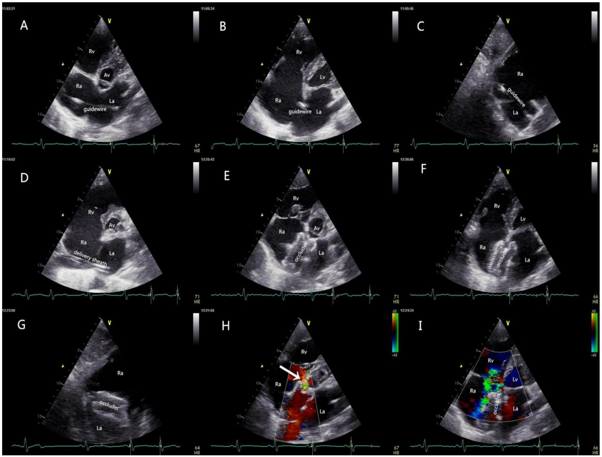 Jcdd 10 00321 g003 Jcdd 10 00321 g003