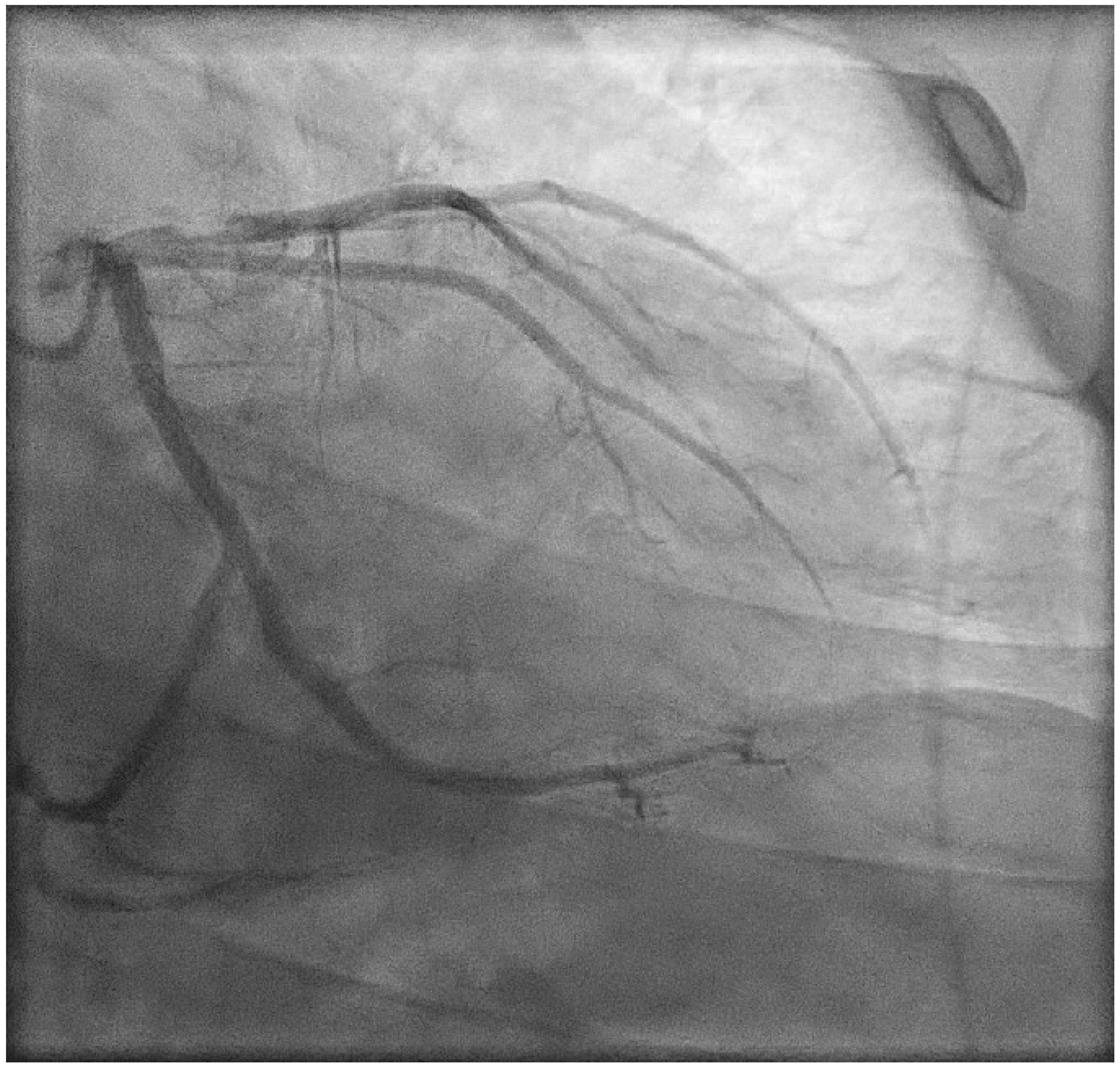 Jcdd 10 00324 g004 Jcdd 10 00324 g004