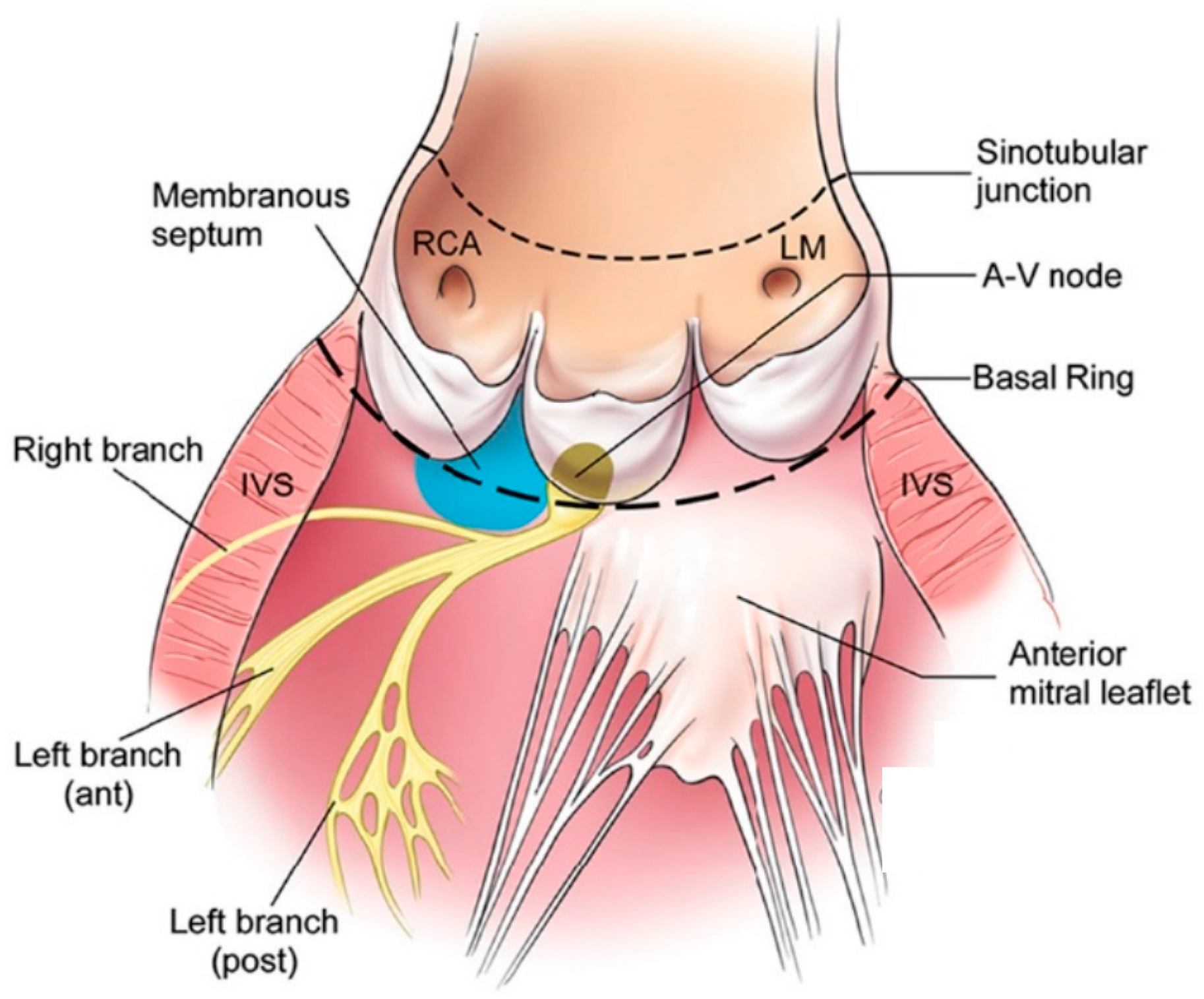 aortic root anatomy