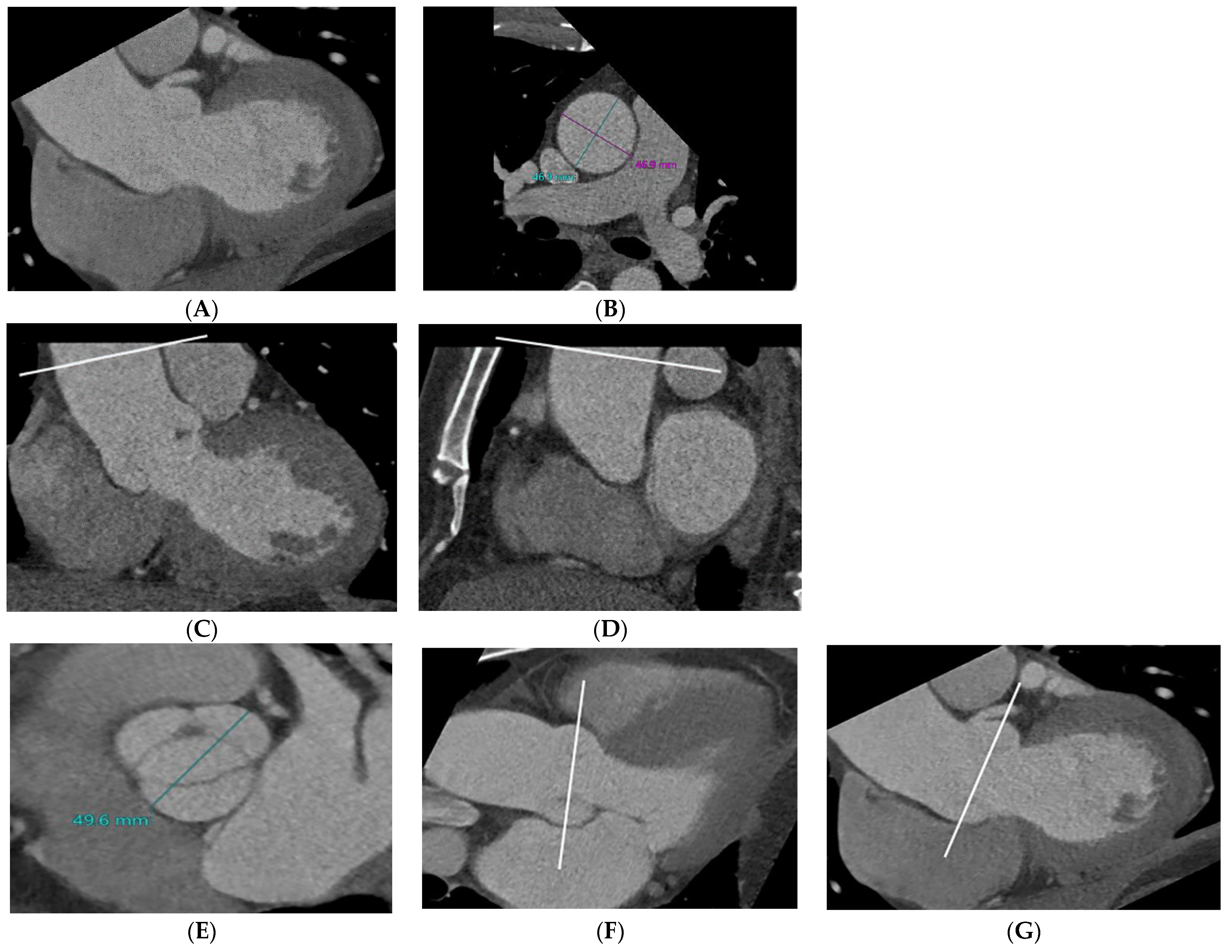 Jcdd 10 00372 g002 Jcdd 10 00372 g002