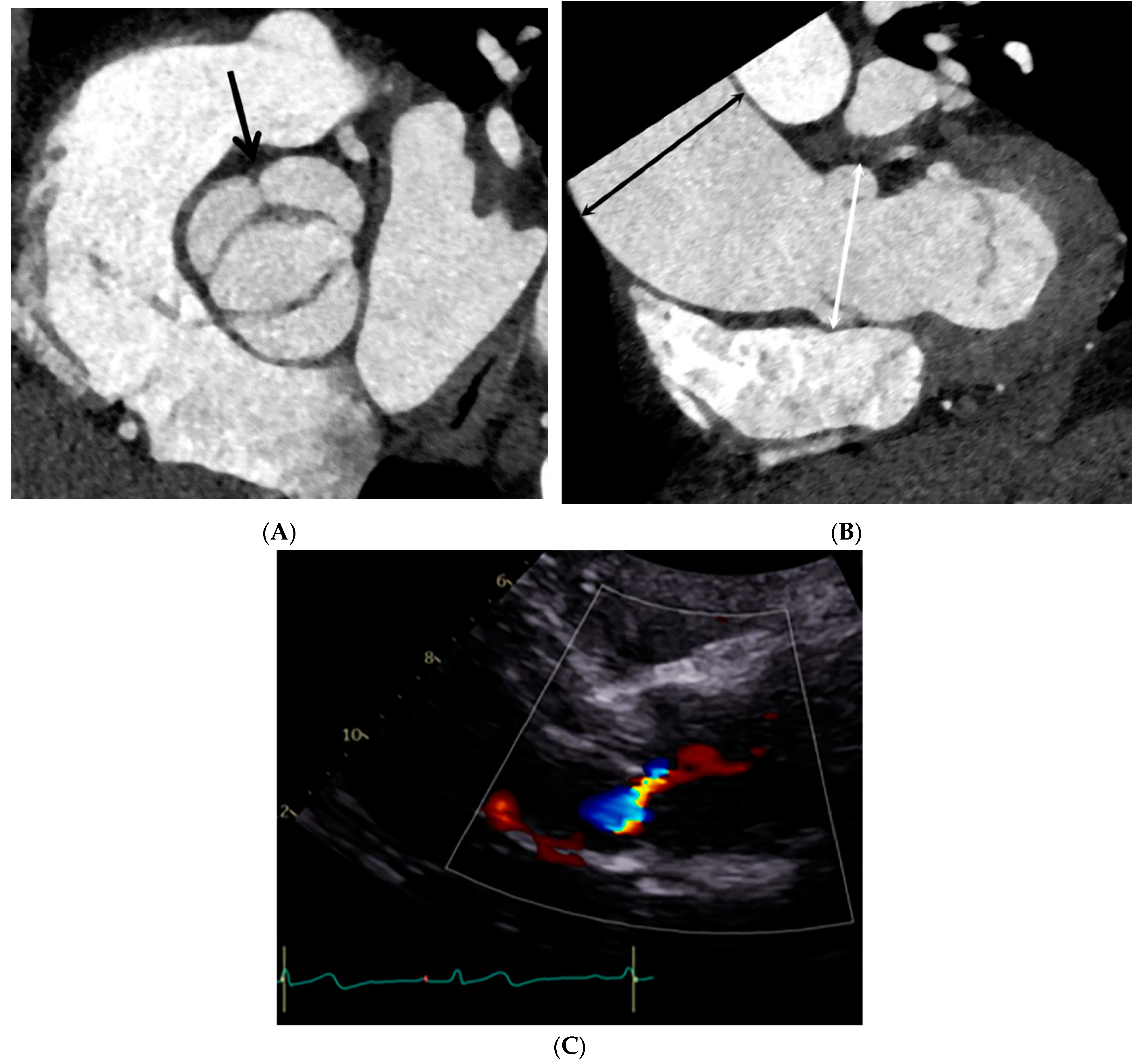 Jcdd 10 00372 g004 Jcdd 10 00372 g004