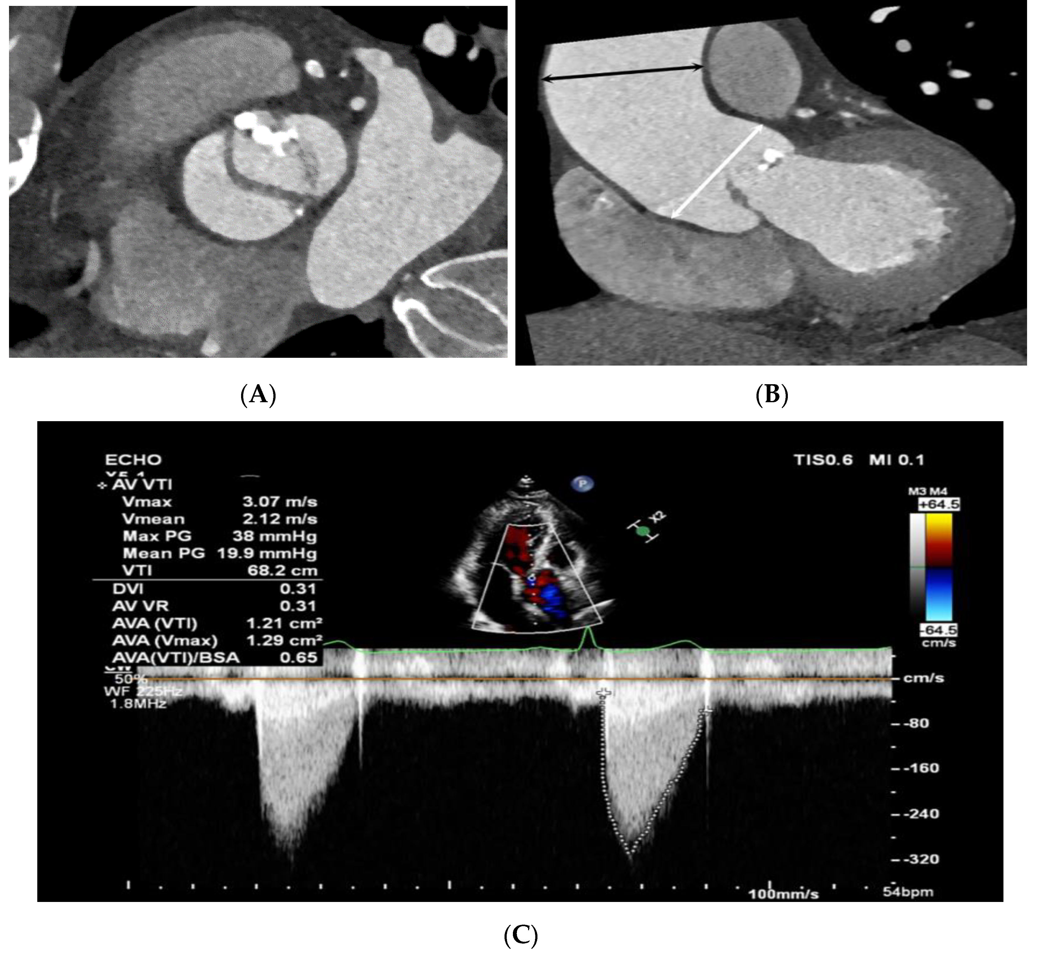 Jcdd 10 00372 g005 Jcdd 10 00372 g005