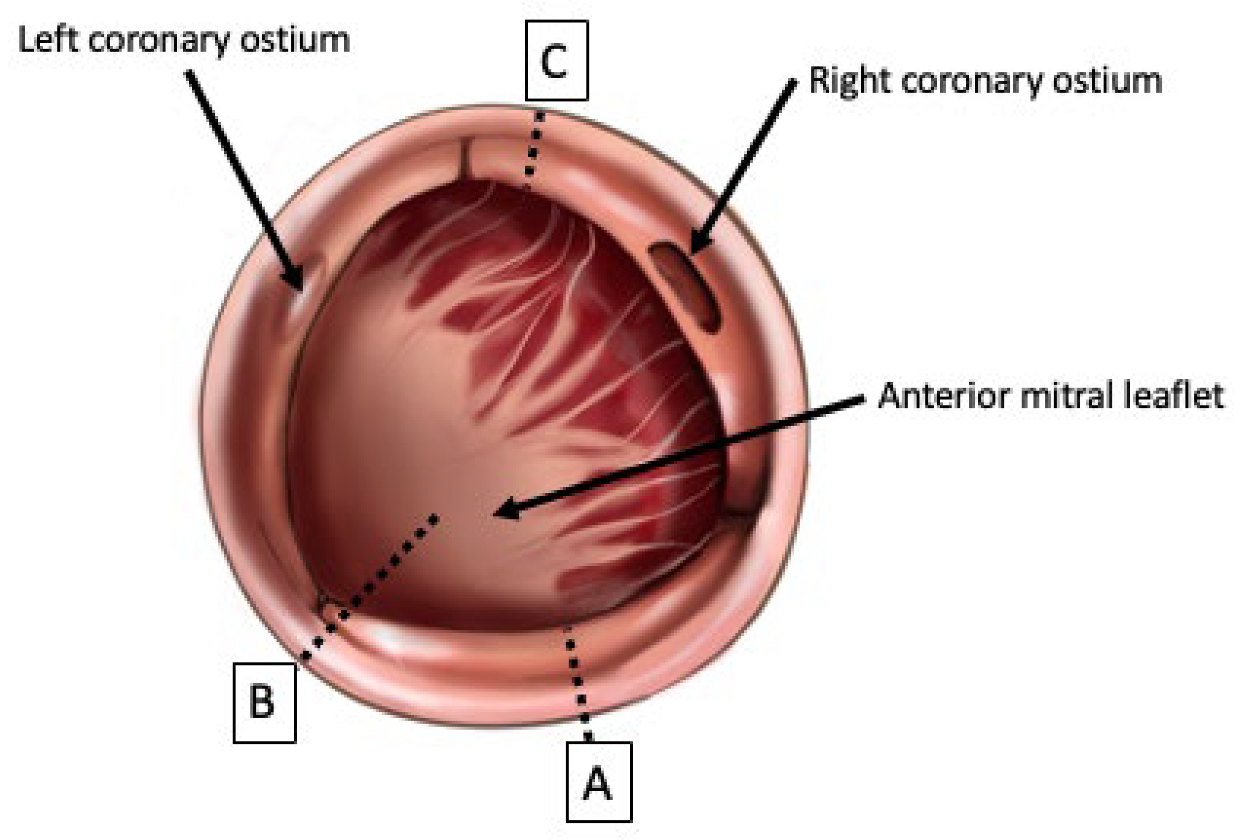 Jcdd 10 00373 g001 Jcdd 10 00373 g001