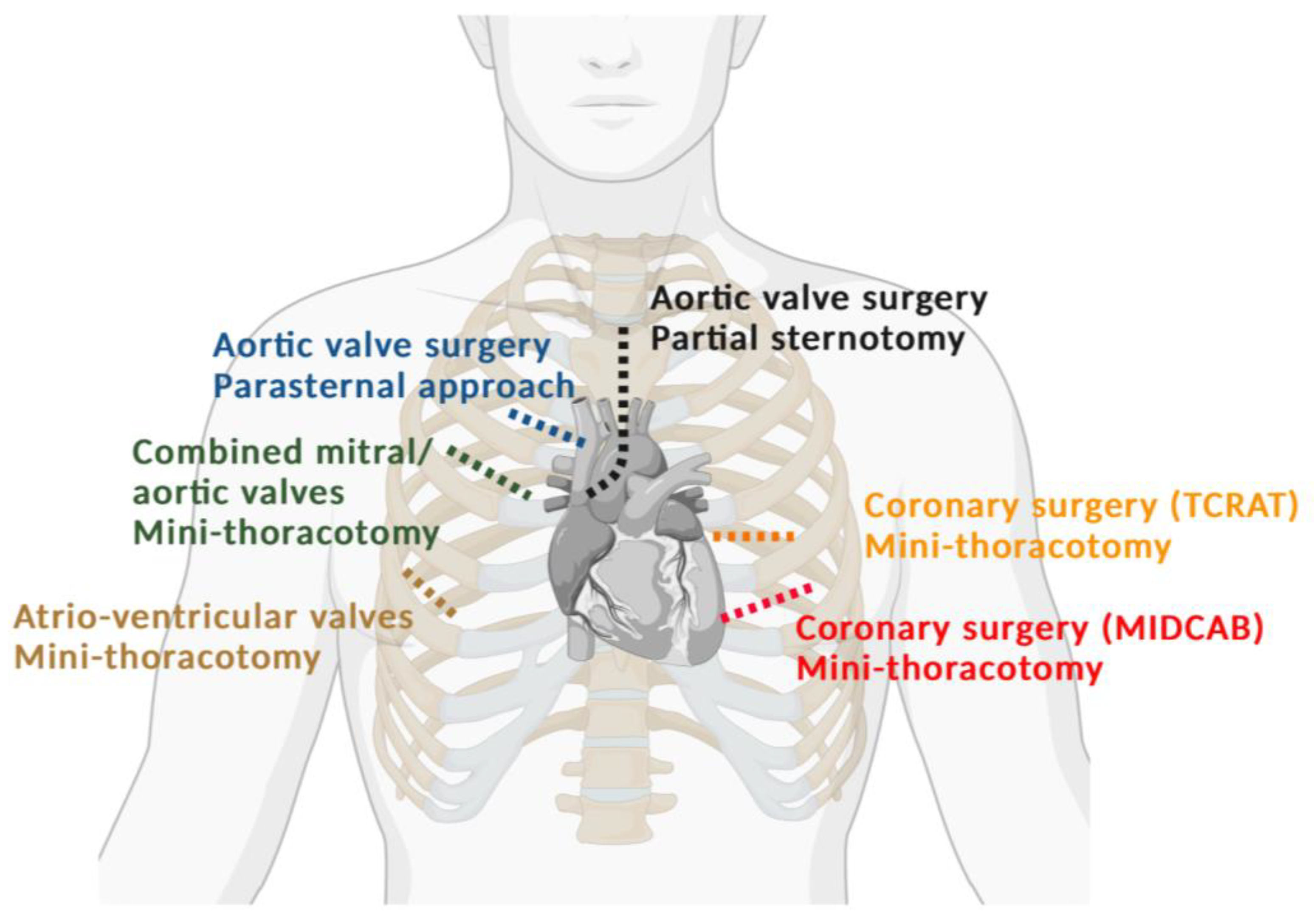 Is There a Future for Minimal Access and Robots in Cardiac
