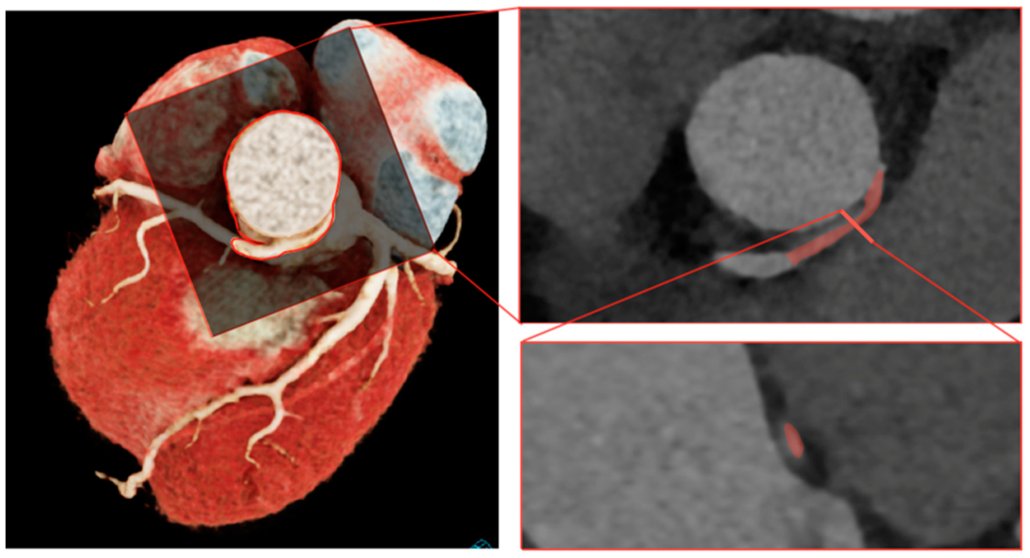 JCDD Free FullText Application of PatientSpecific Computational Fluid Dynamics in