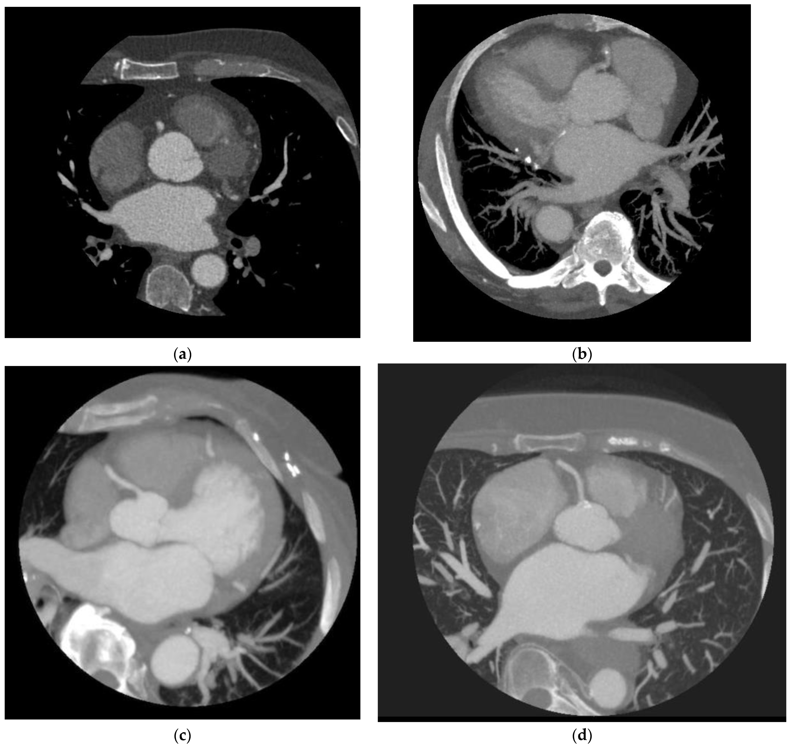 JCDD Free Full Text Evaluation Of Image Quality For High Heart jcdd-free-full-text-evaluation-of-image-quality-for-high-heart