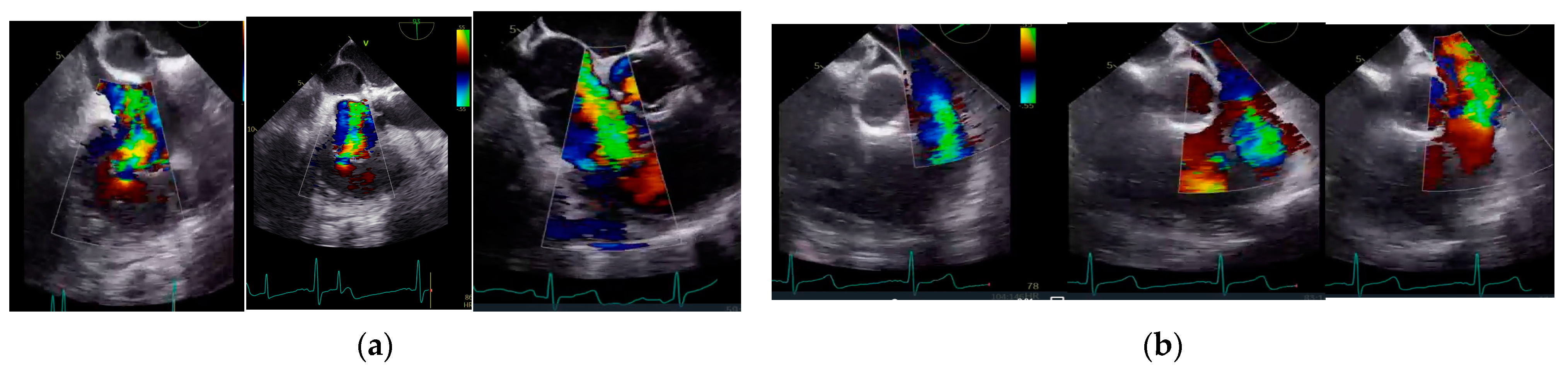 Jcdd 10 00413 g001 Jcdd 10 00413 g001