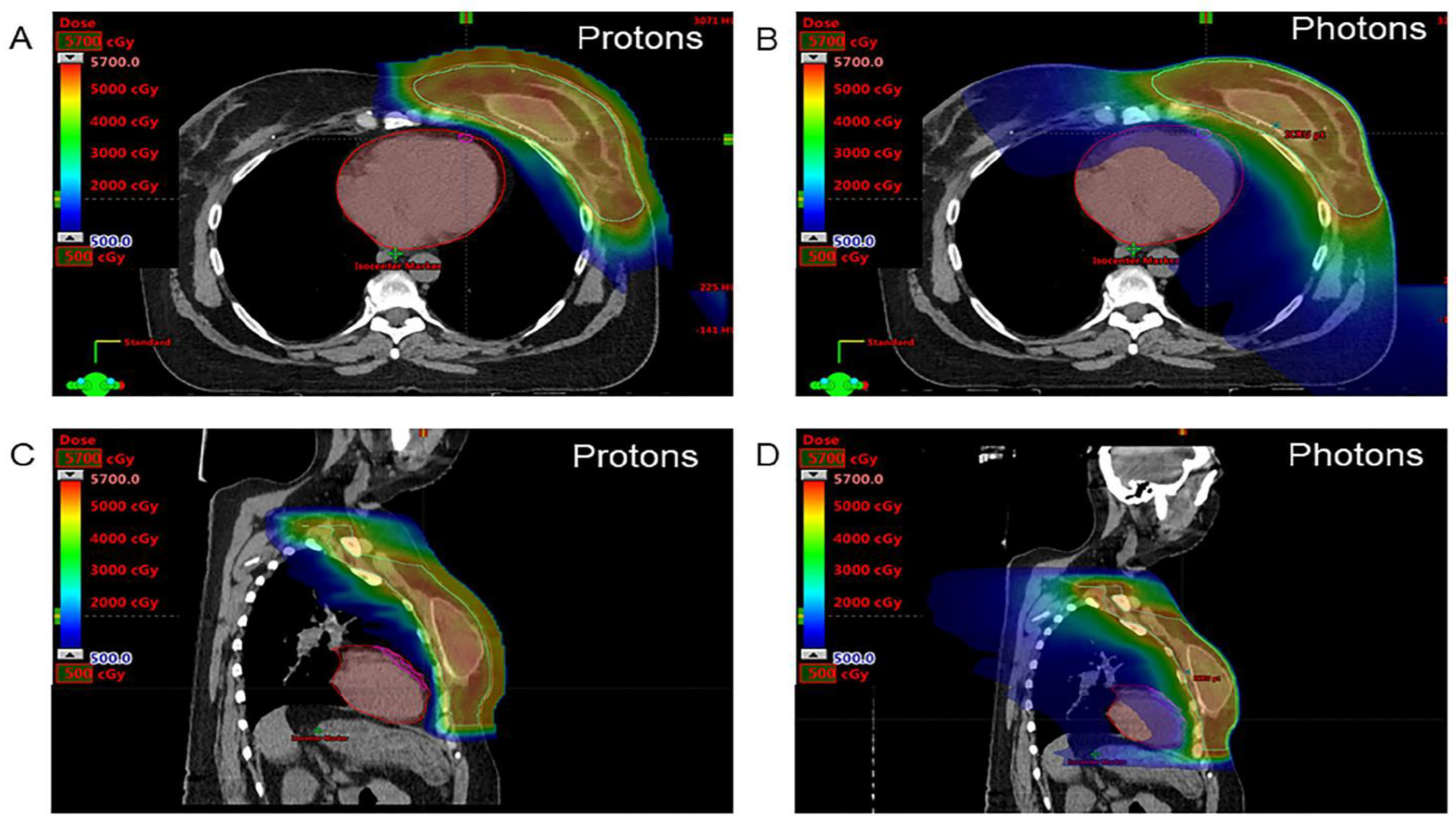 Quantification of Breast Volume According to age and BMI: A  Three-Dimensional MRI Analysis of 400 Women