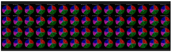 Deep Learning Paradigm and Its Bias for Coronary Artery Wall ...