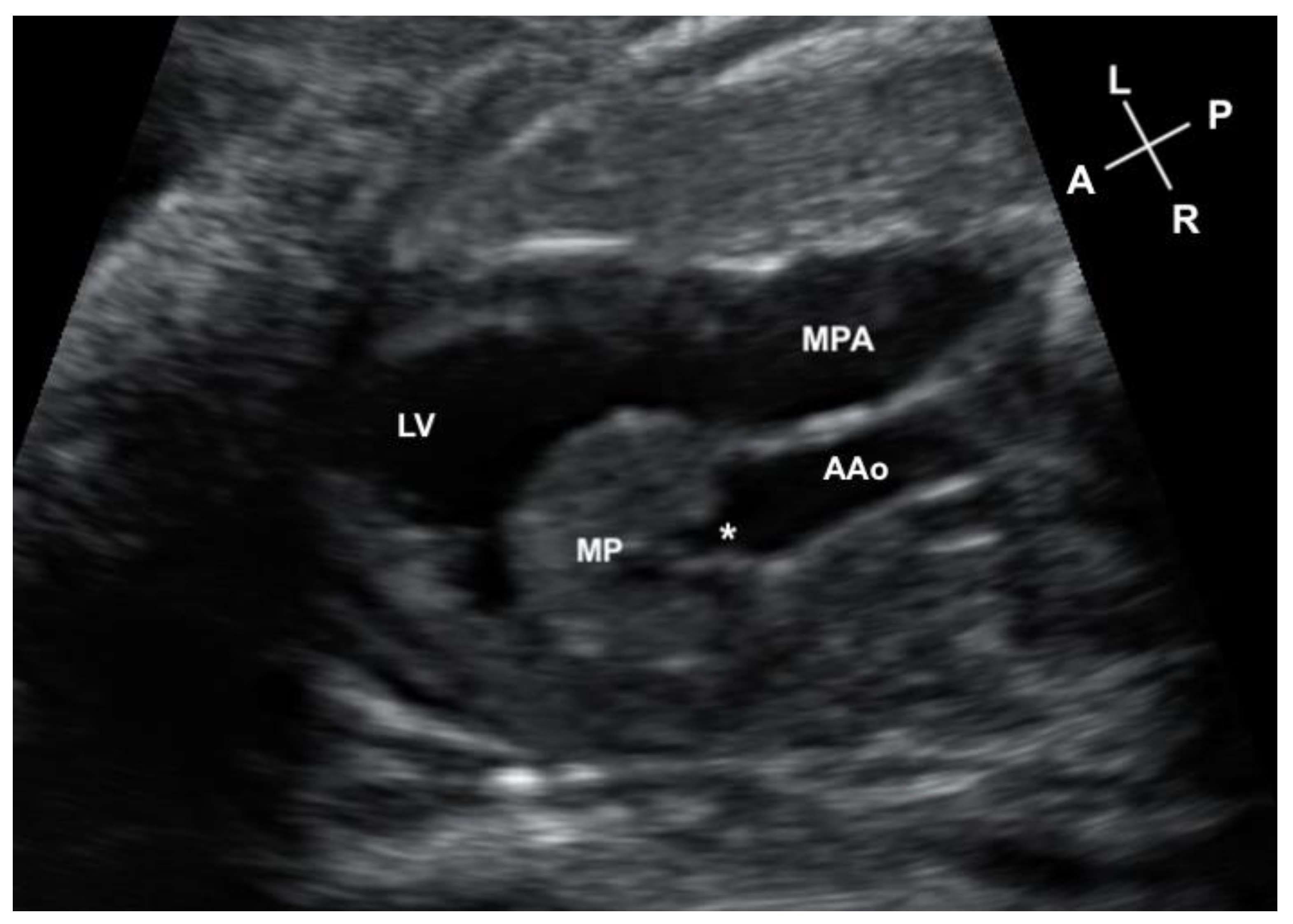 Jcdd 11 00023 g001 Jcdd 11 00023 g001