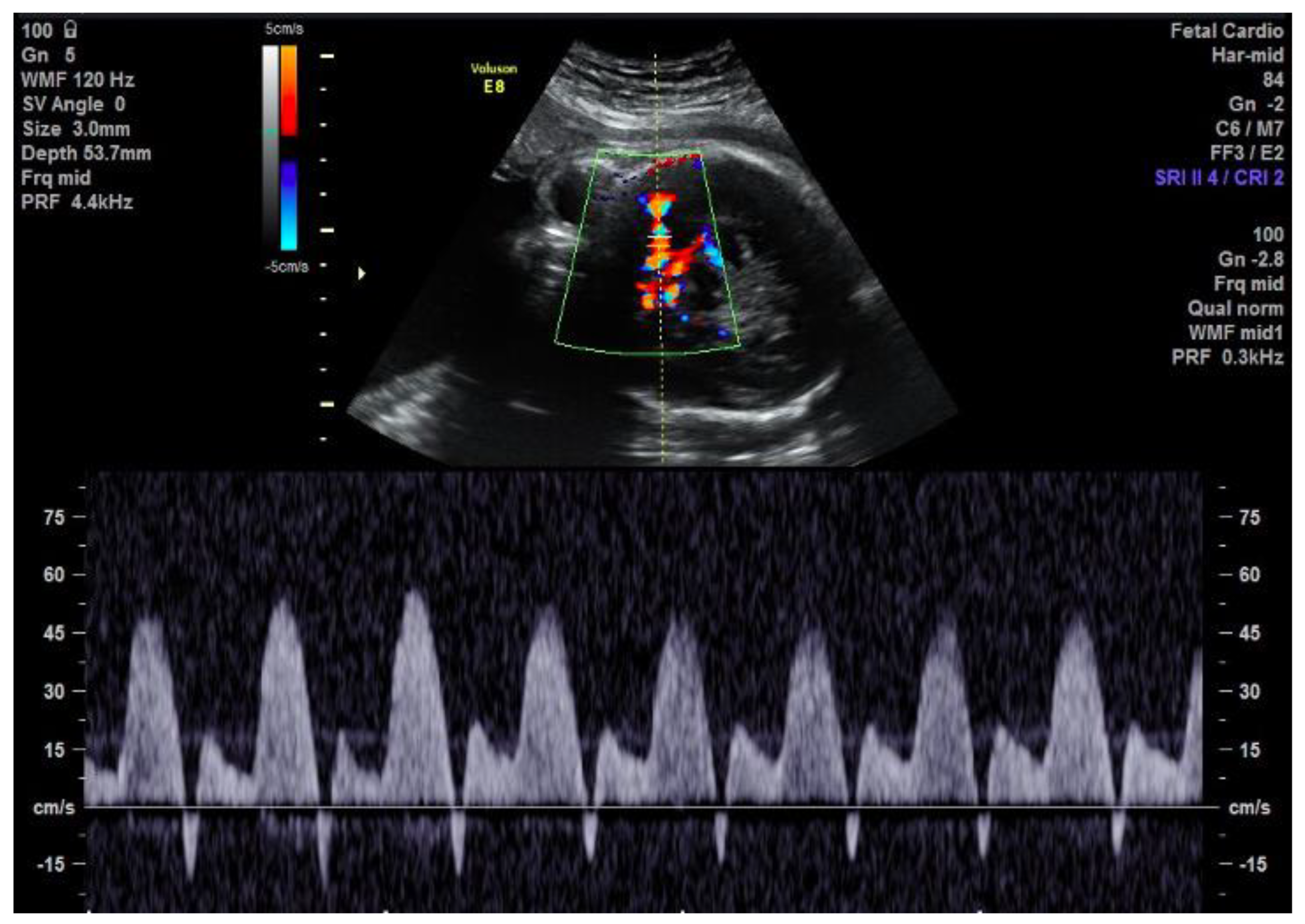 Jcdd 11 00023 g002 Jcdd 11 00023 g002