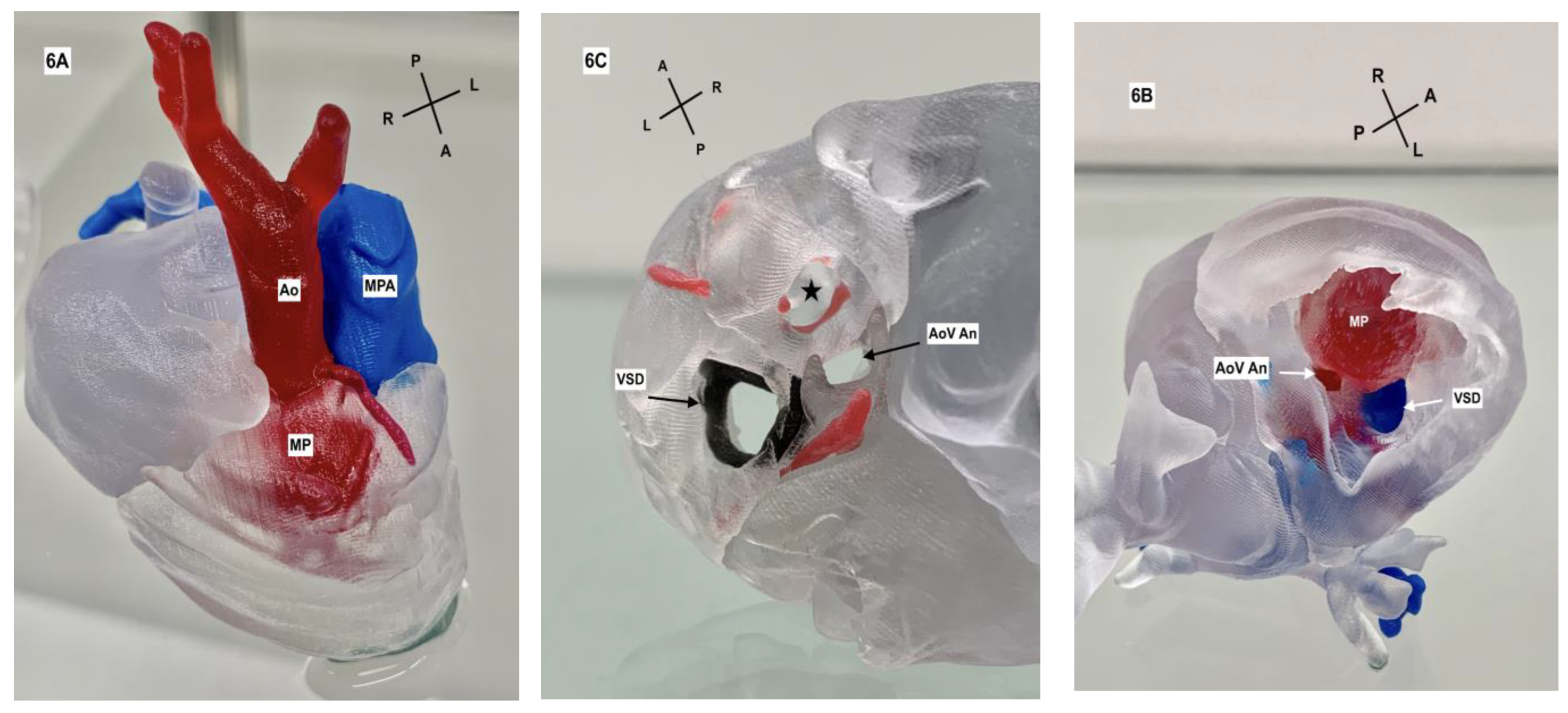 Jcdd 11 00023 g006 Jcdd 11 00023 g006