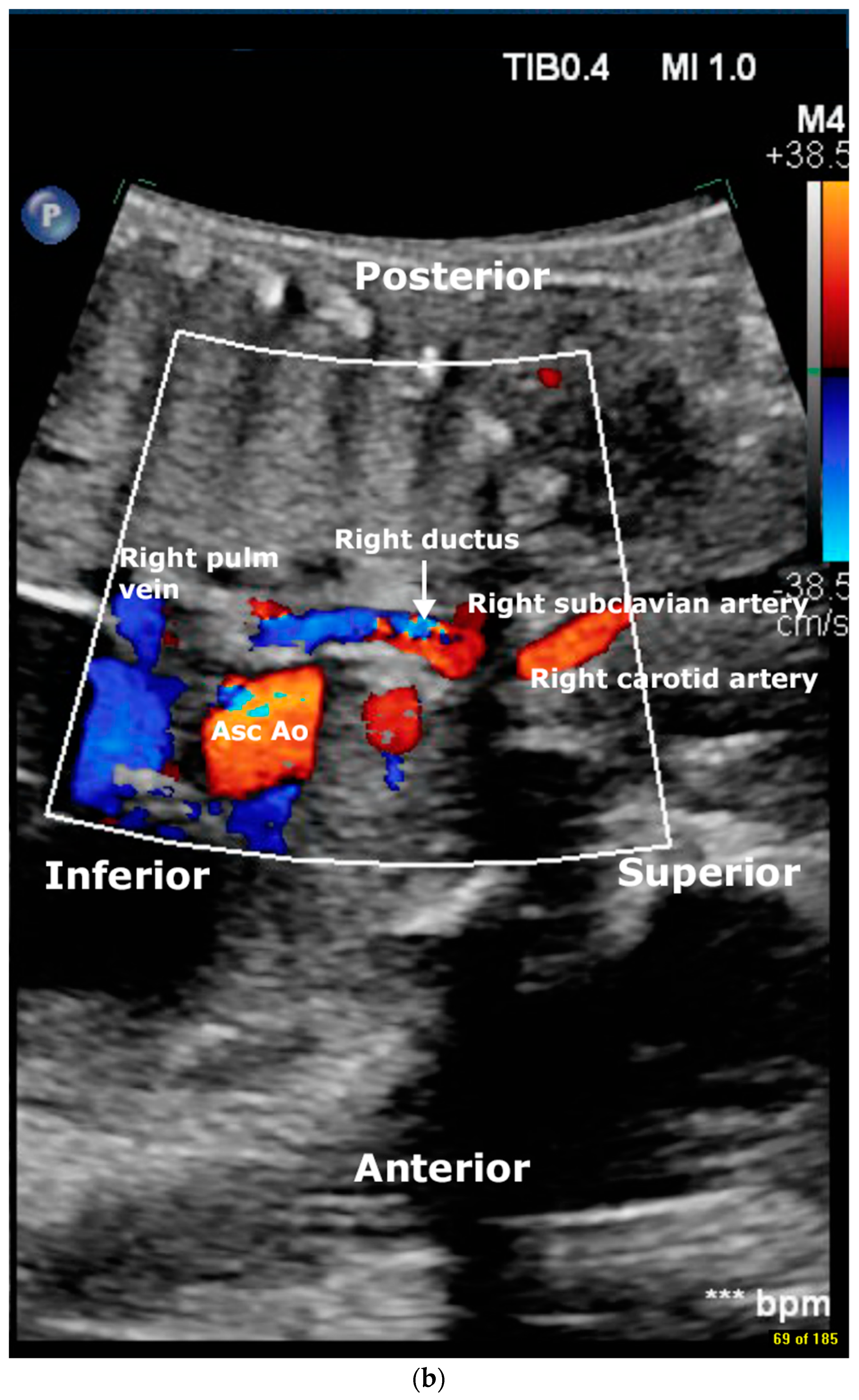 Jcdd 11 00055 g001b Jcdd 11 00055 g001b