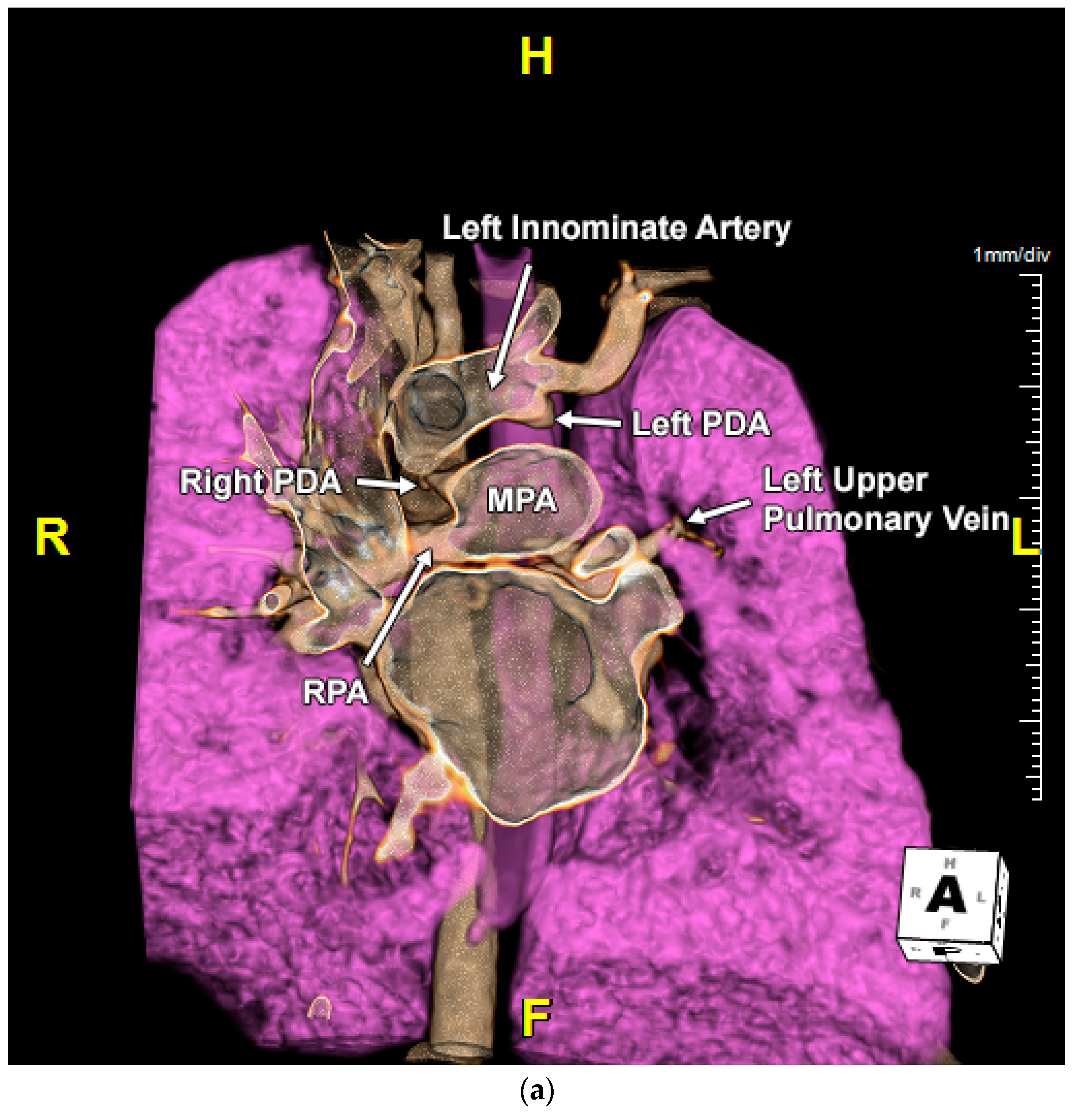 Jcdd 11 00055 g002a Jcdd 11 00055 g002a