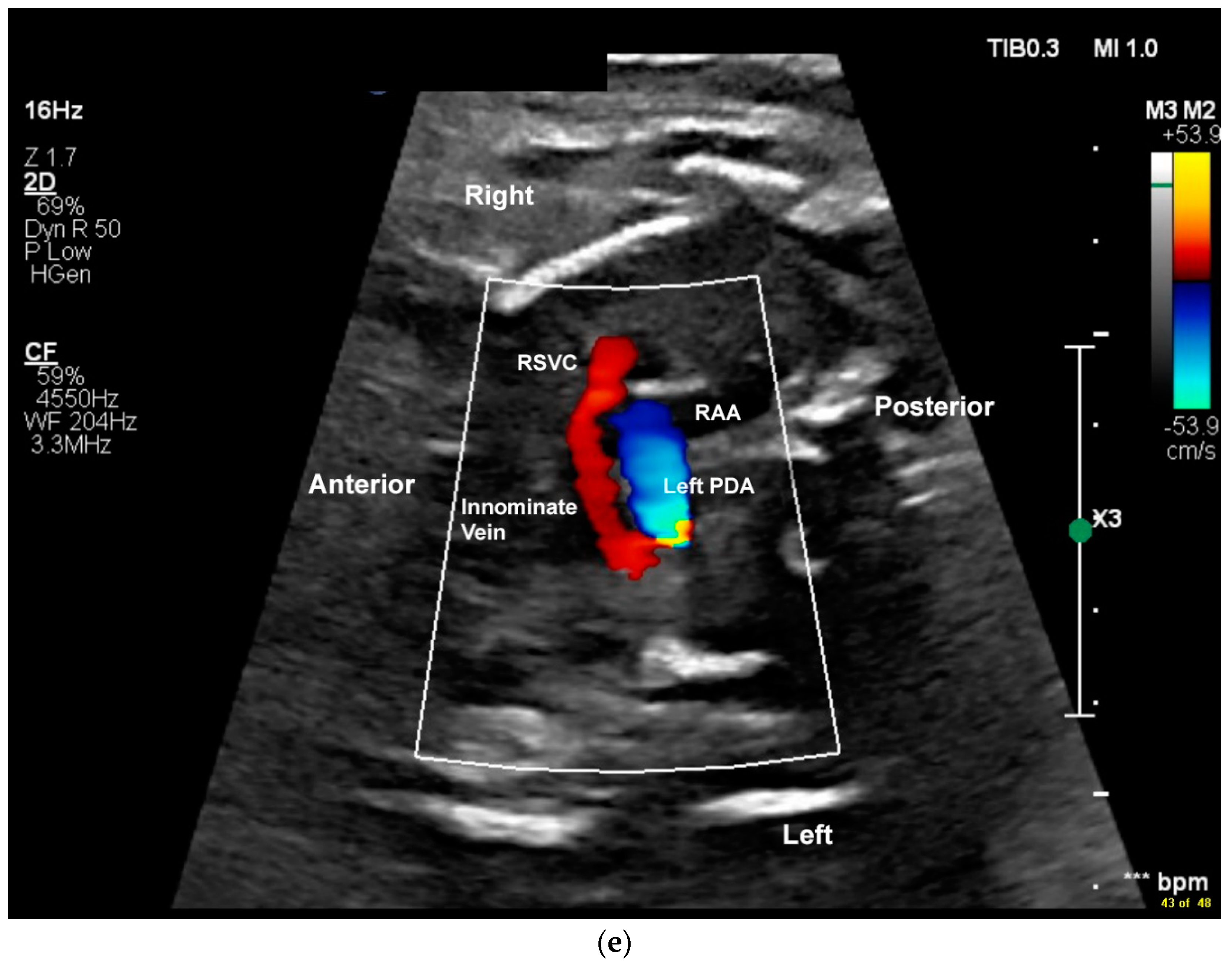 Jcdd 11 00055 g002d Jcdd 11 00055 g002d