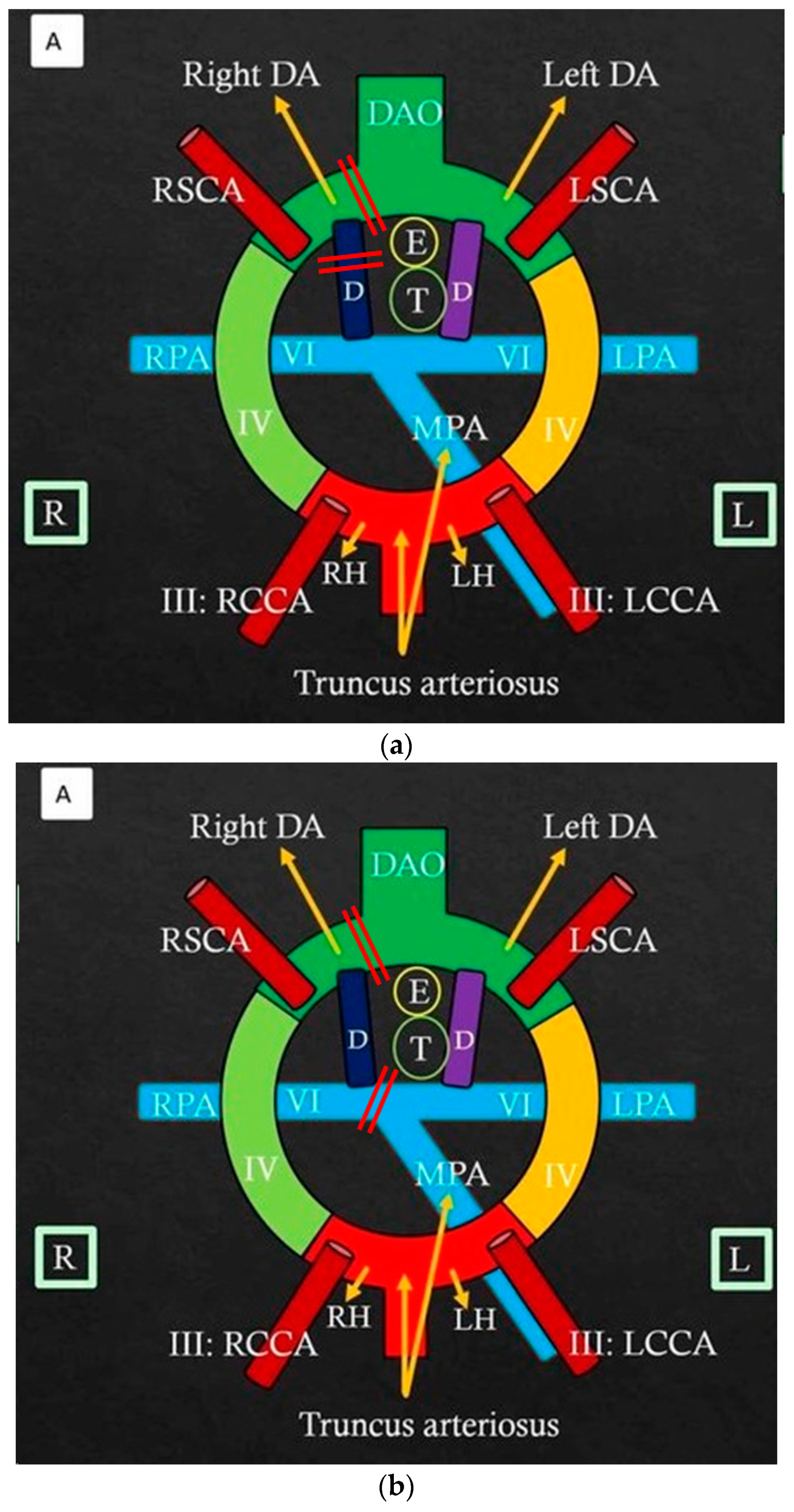Jcdd 11 00055 g003a Jcdd 11 00055 g003a