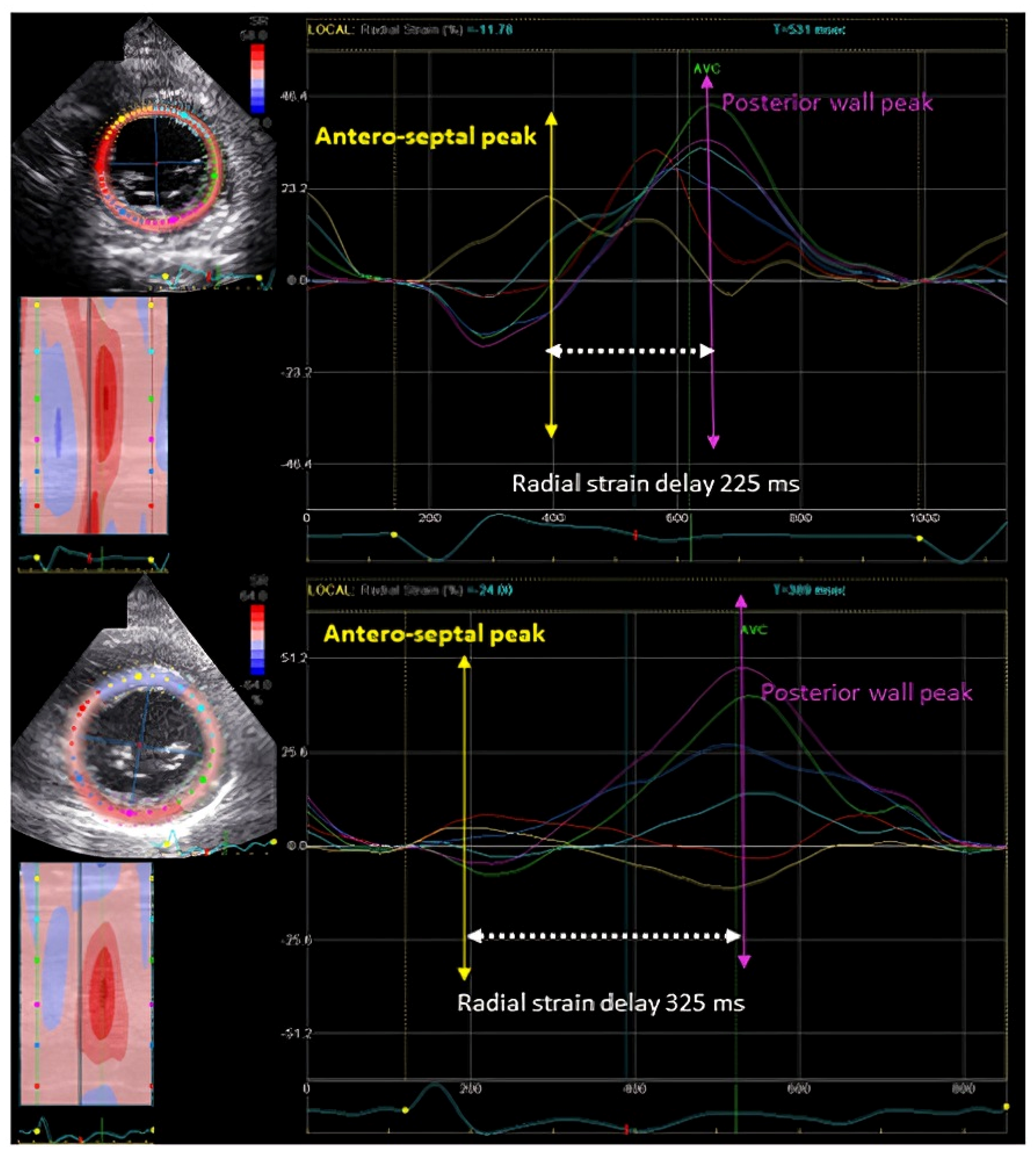 Jcdd 11 00064 g002 Jcdd 11 00064 g002