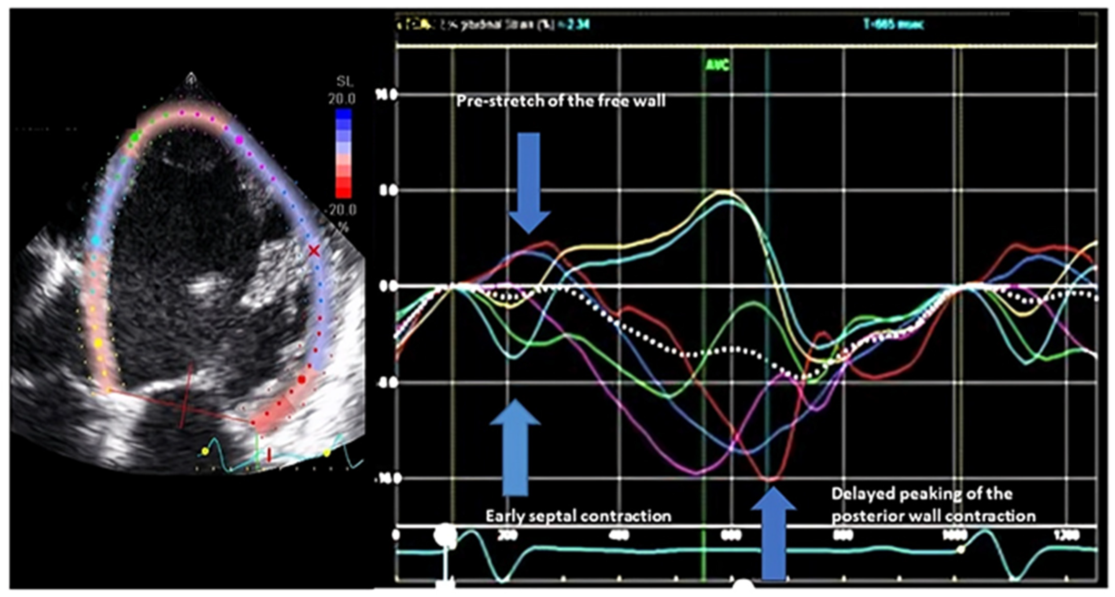 Jcdd 11 00064 g004 Jcdd 11 00064 g004