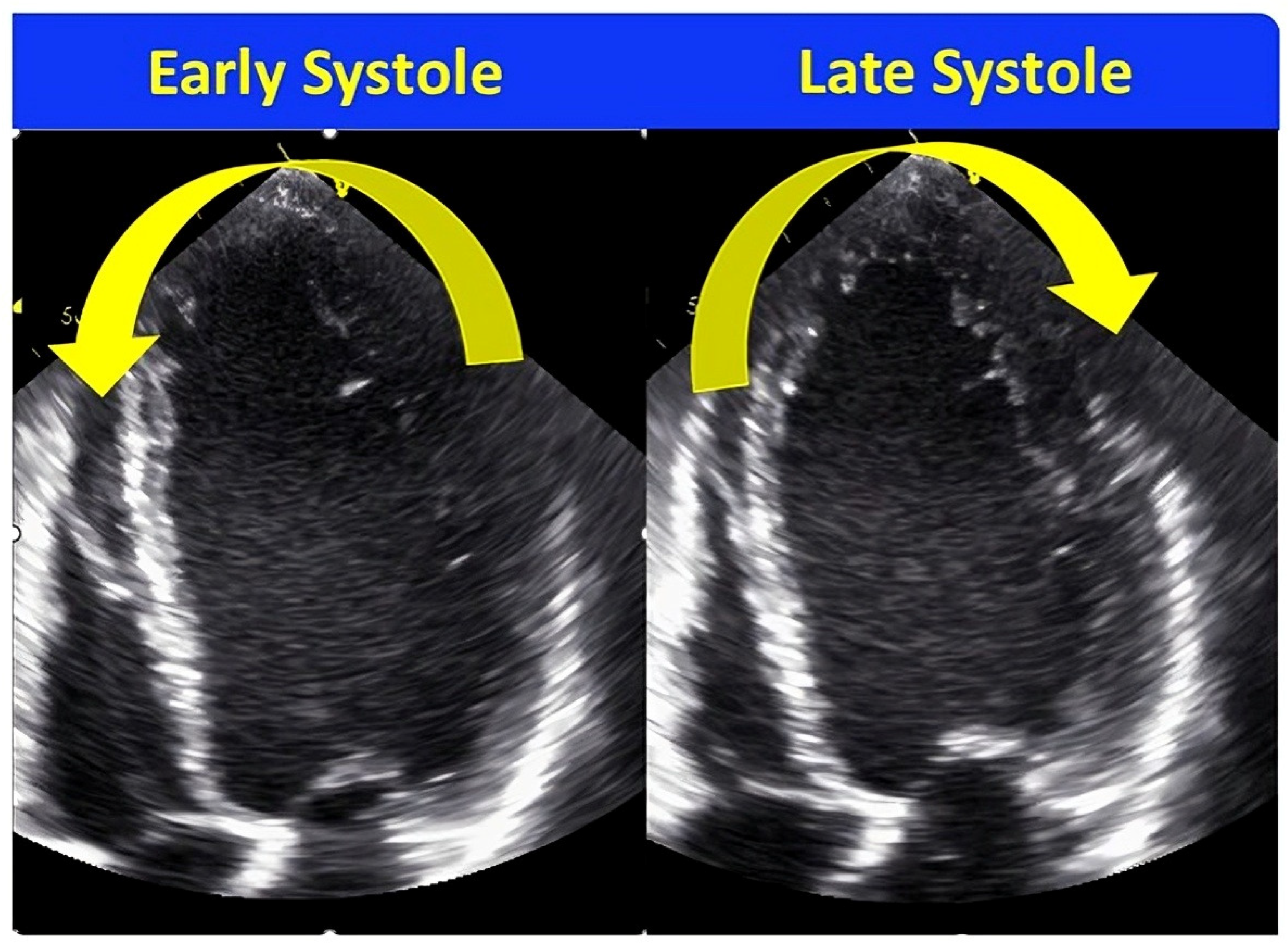 Jcdd 11 00064 g005 Jcdd 11 00064 g005