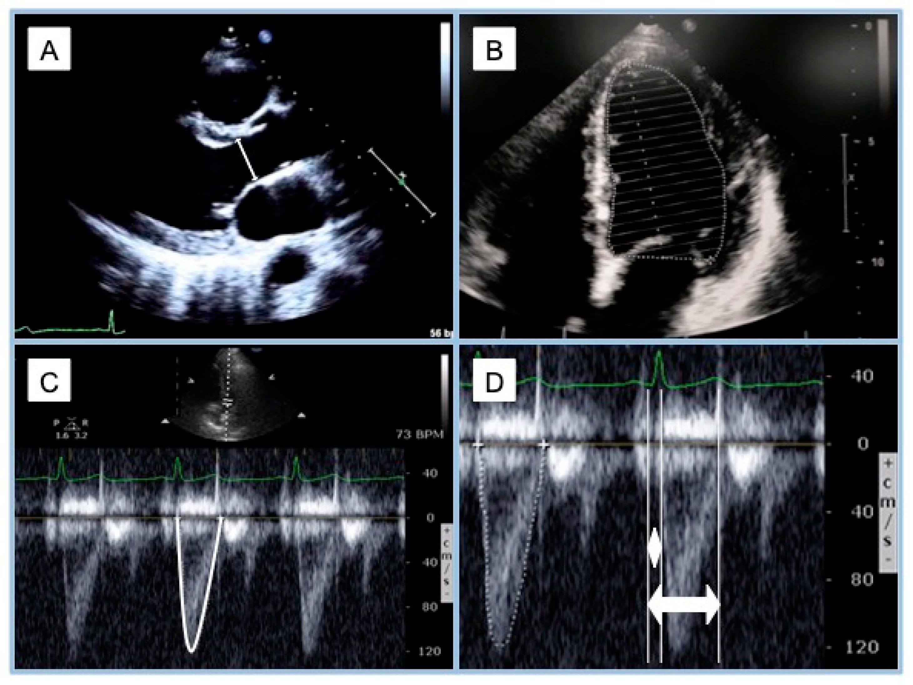Jcdd 11 00141 g004 Jcdd 11 00141 g004