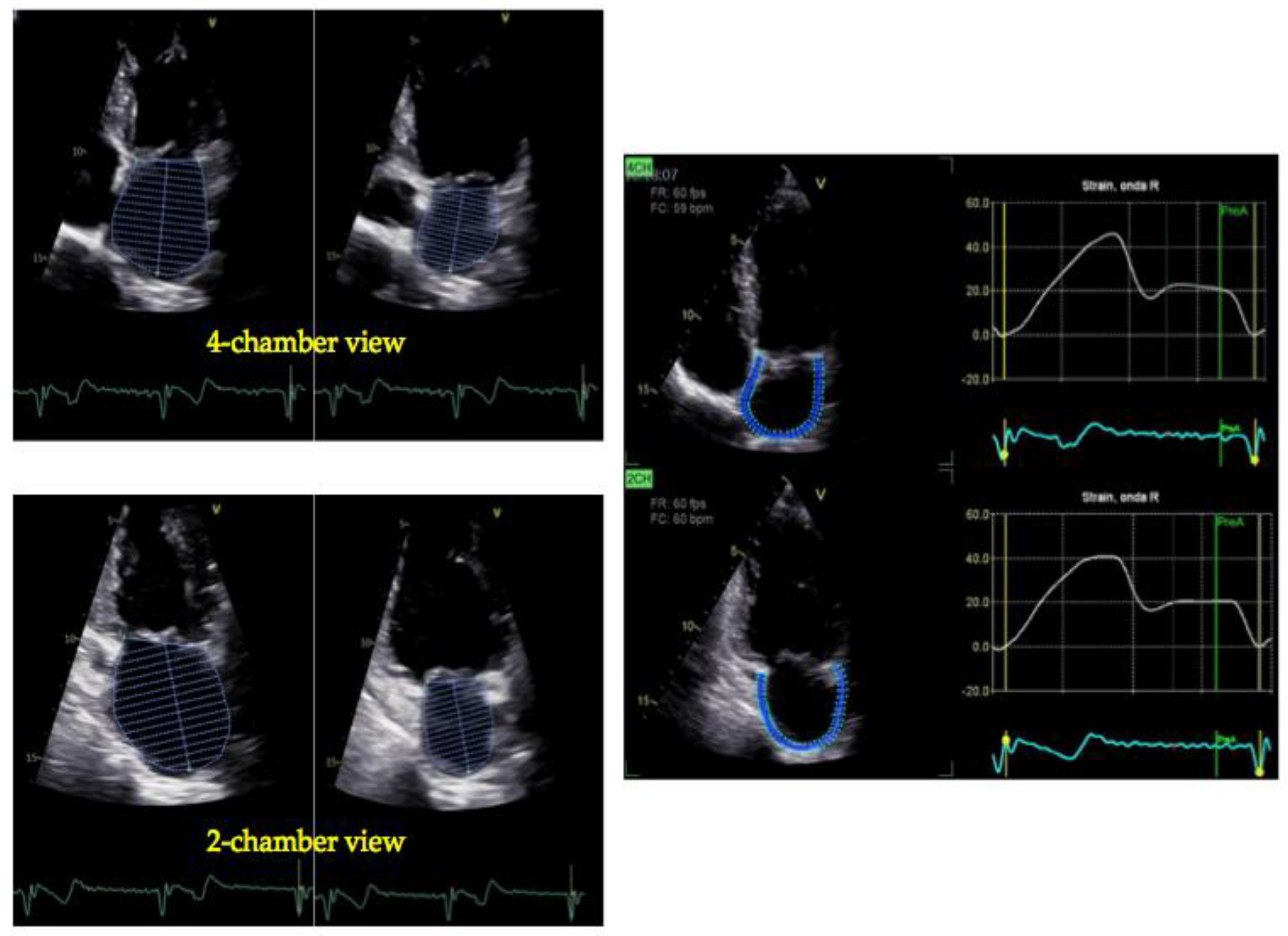 Jcdd 11 00241 g002 Jcdd 11 00241 g002