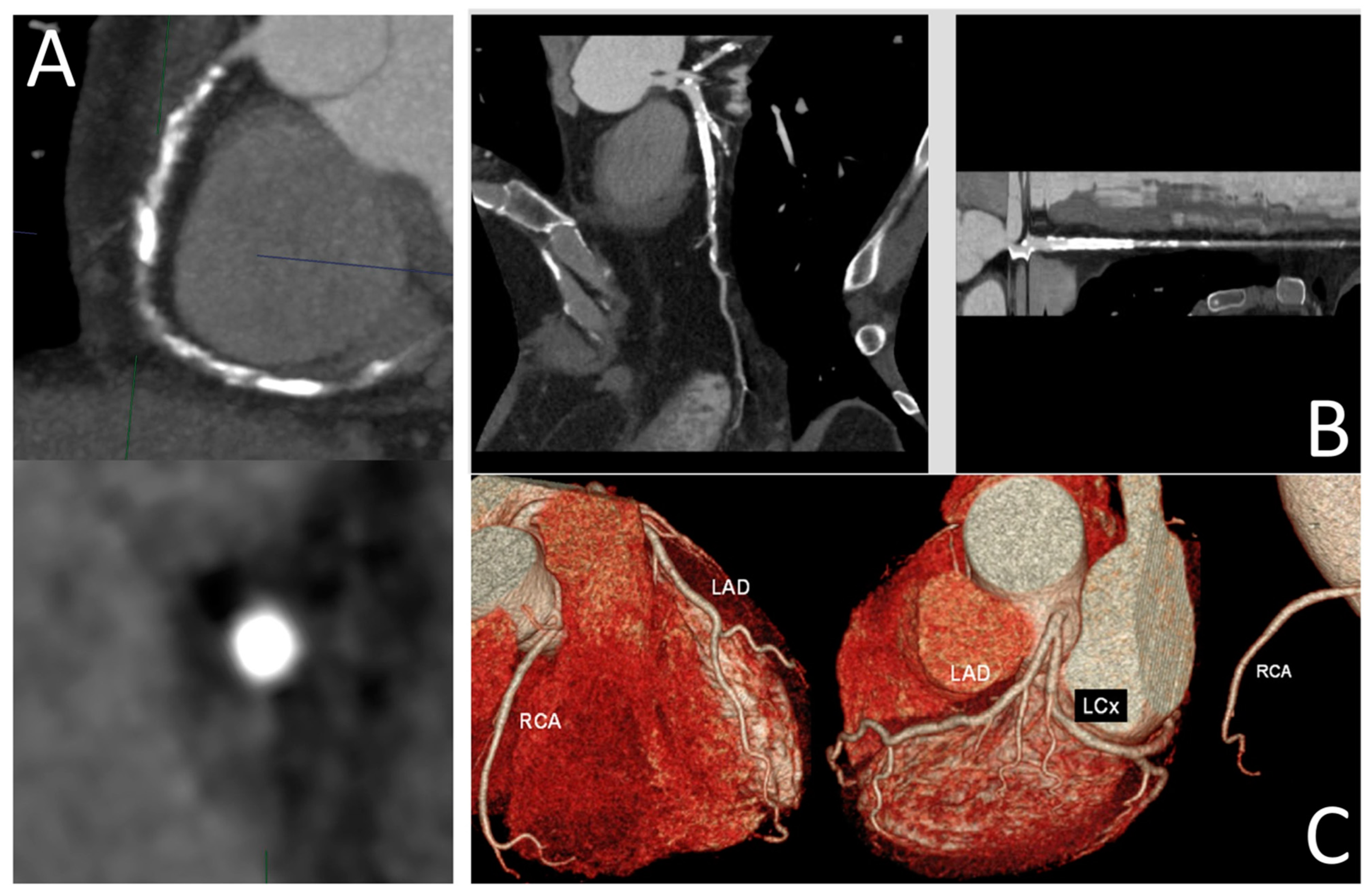 Jcdd 11 00295 g003 Jcdd 11 00295 g003