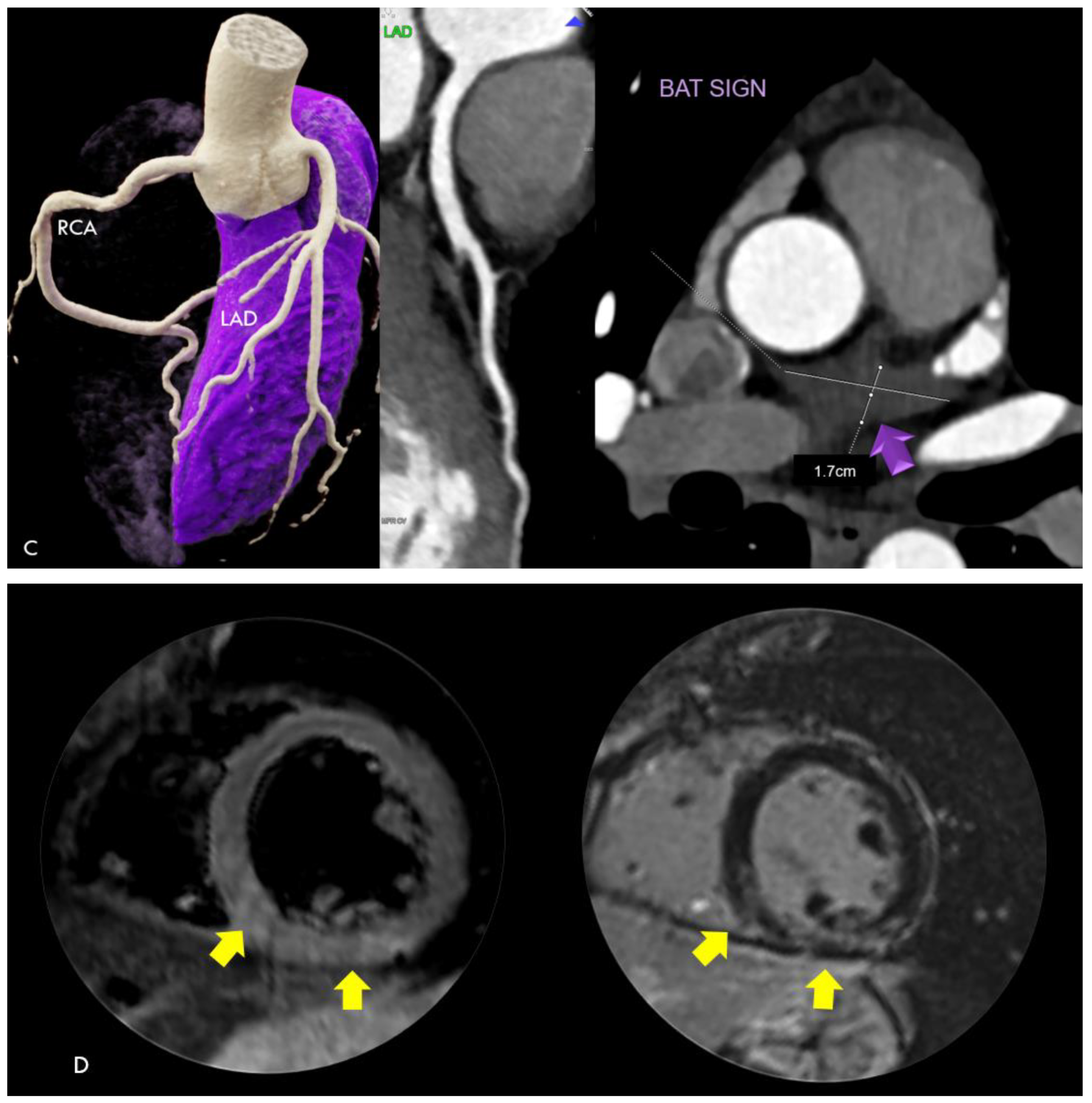 Jcdd 11 00325 g001b Jcdd 11 00325 g001b