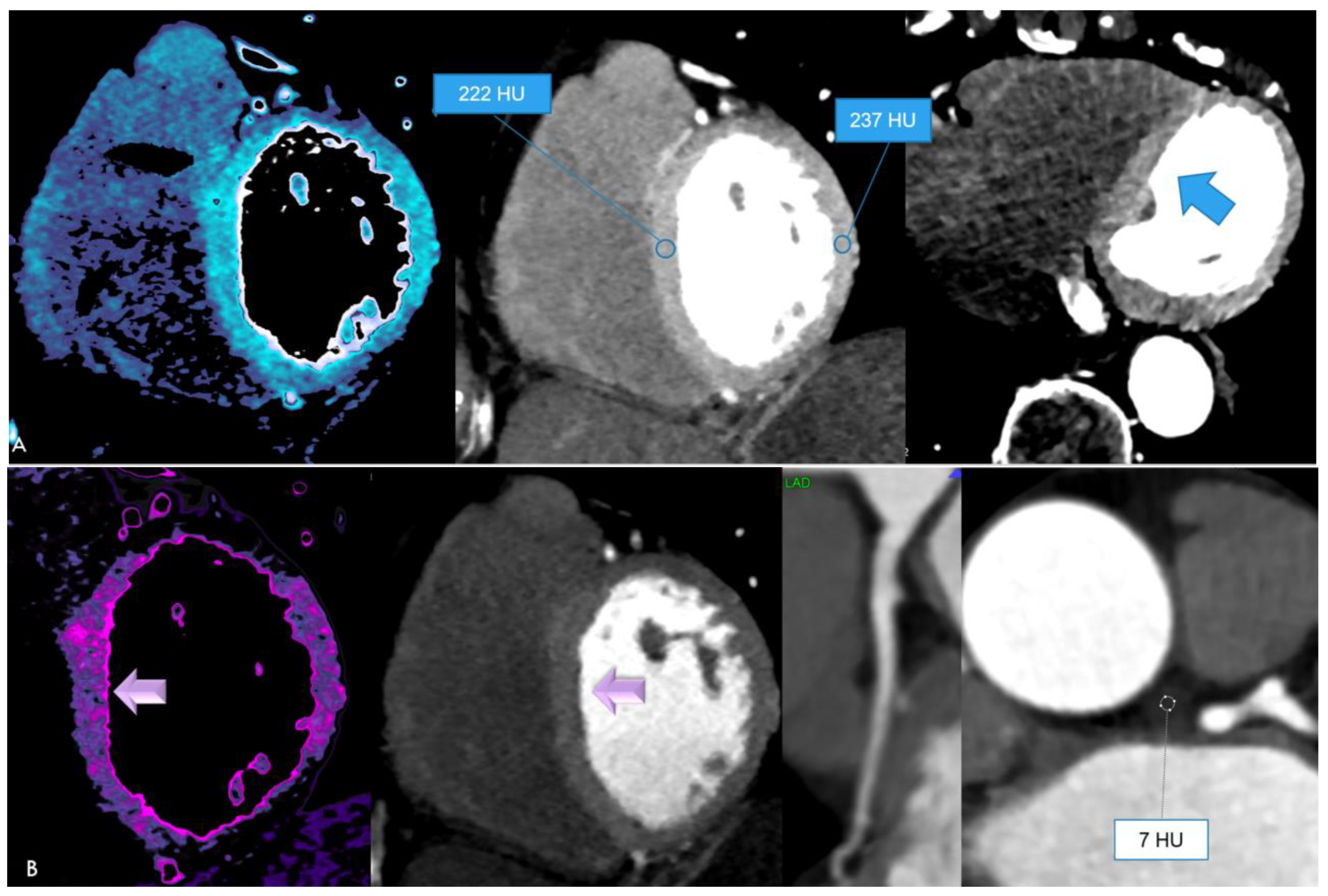Jcdd 11 00325 g002 Jcdd 11 00325 g002