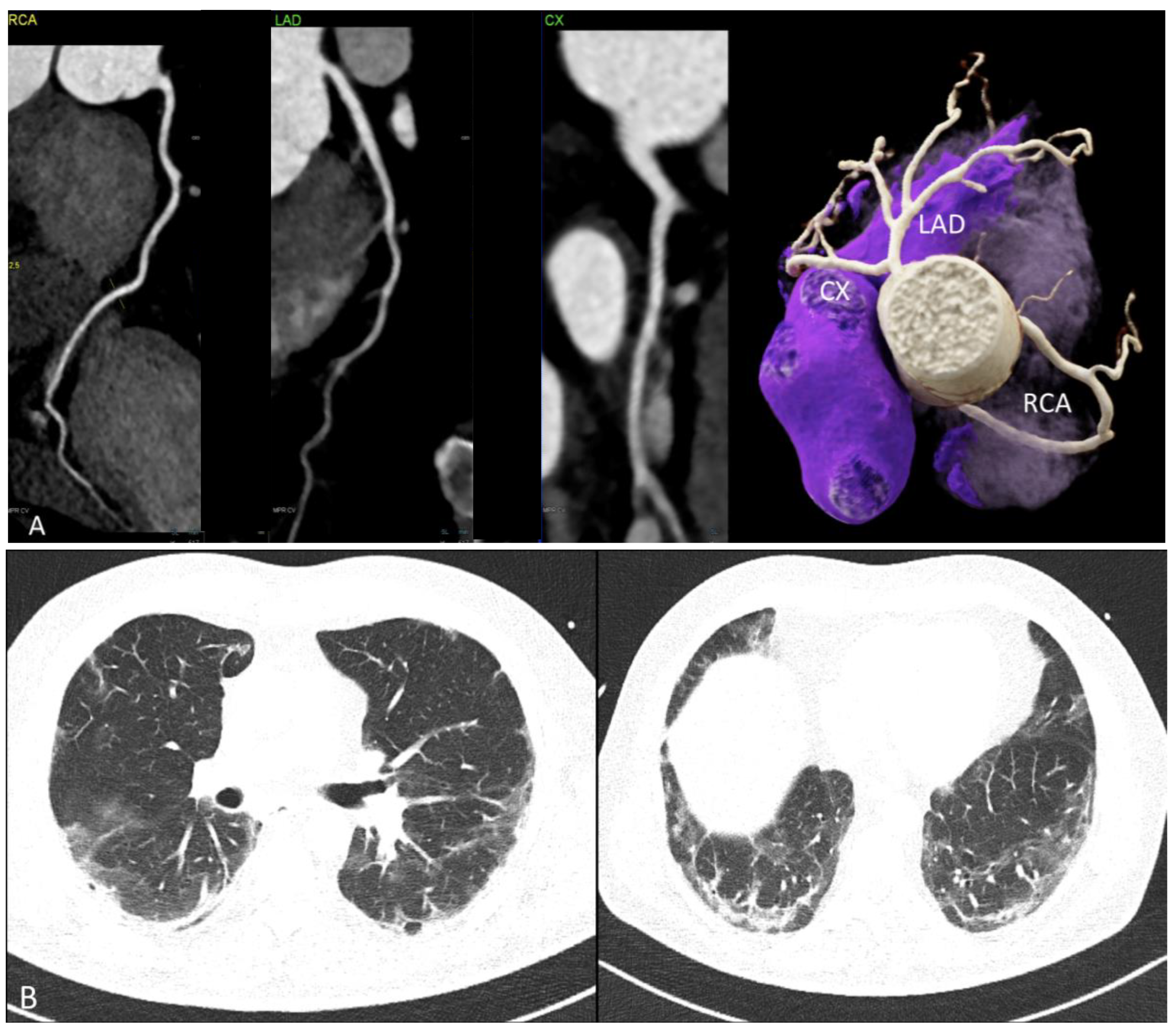 Jcdd 11 00325 g004 Jcdd 11 00325 g004