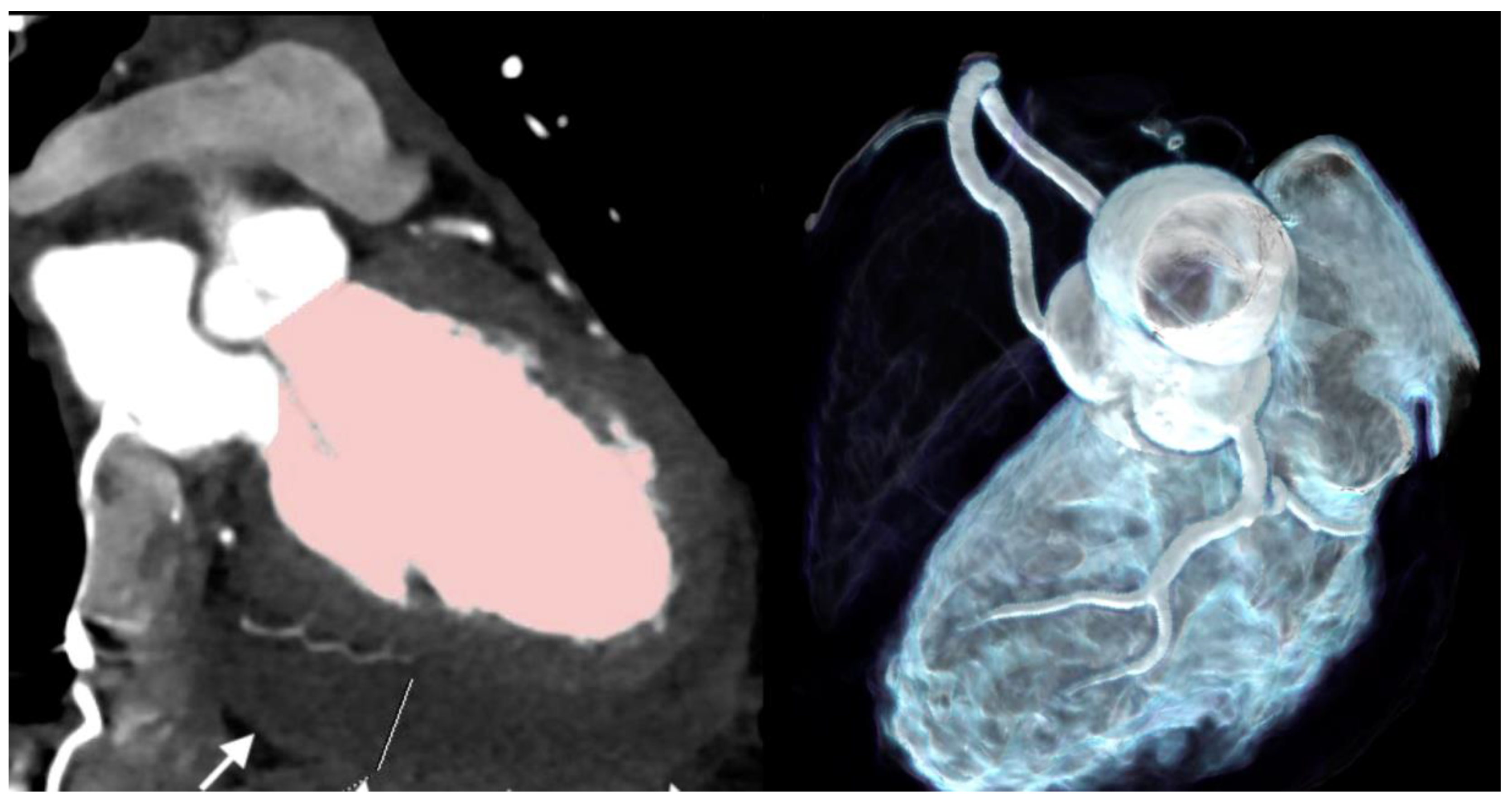 Jcdd 11 00325 g005 Jcdd 11 00325 g005