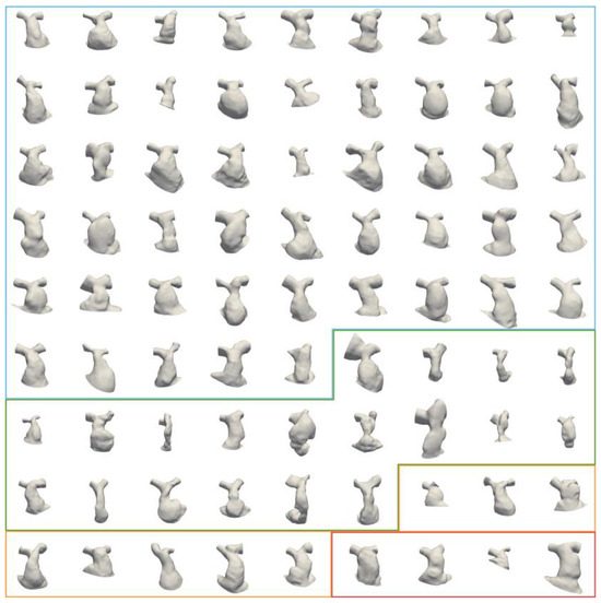 A 3D Statistical Shape Model of the Right Ventricular Outflow Tract in ...