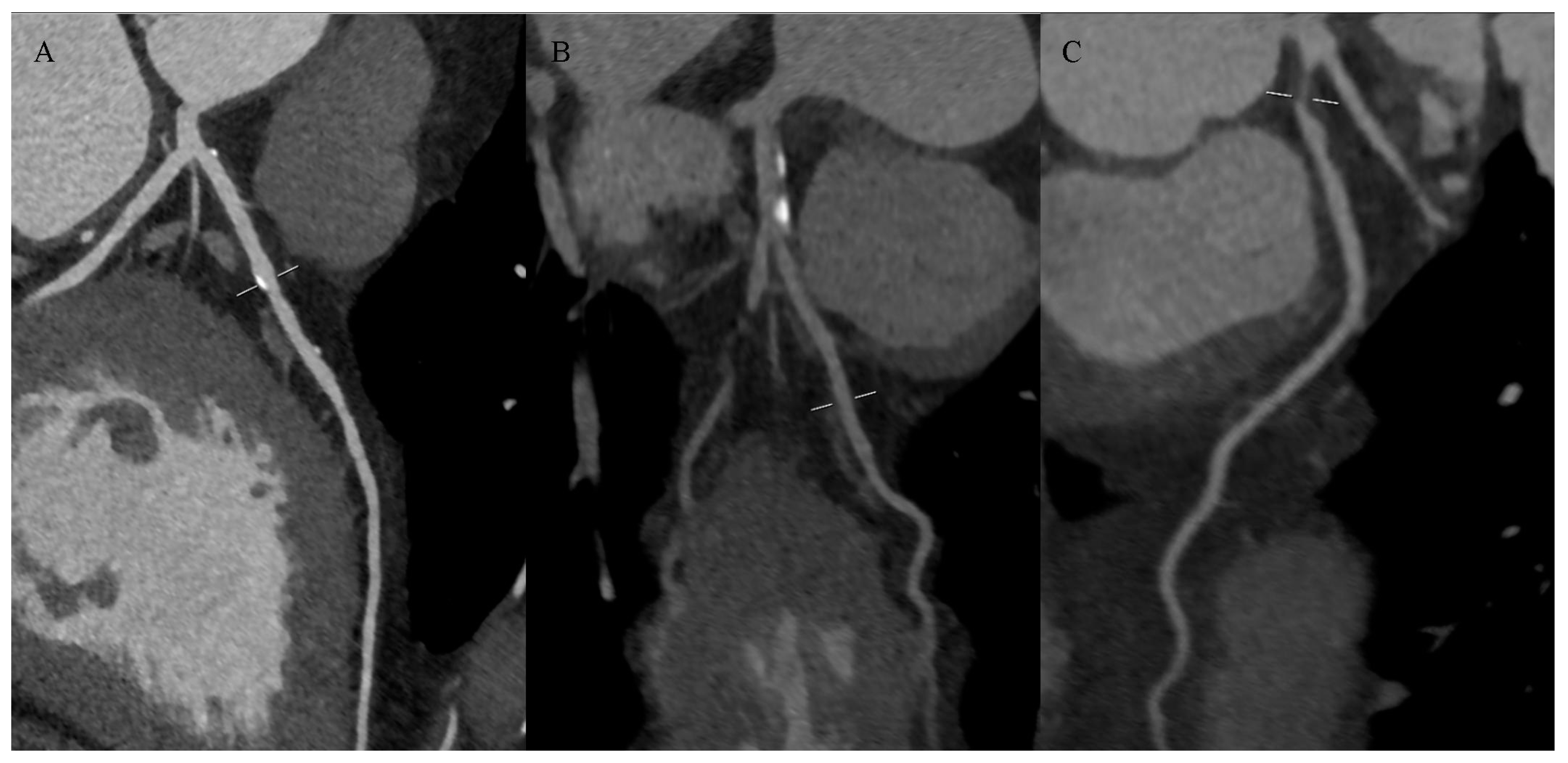 Jcdd 11 00343 g005 Jcdd 11 00343 g005