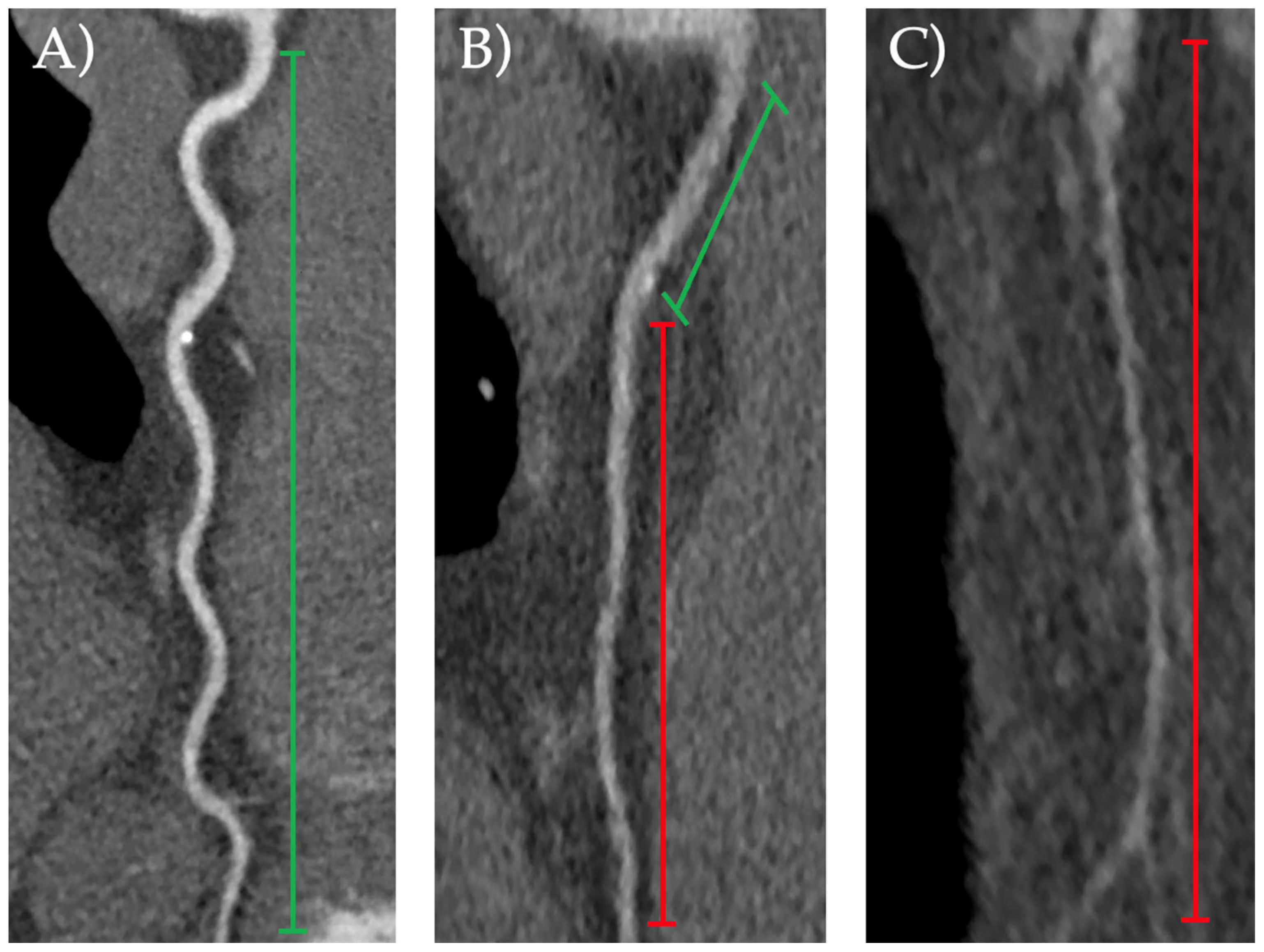 Jcdd 11 00400 g001 Jcdd 11 00400 g001
